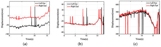 Sensors Free Full Text Dynamic Visual Measurement Of Driver Eye Movements Html