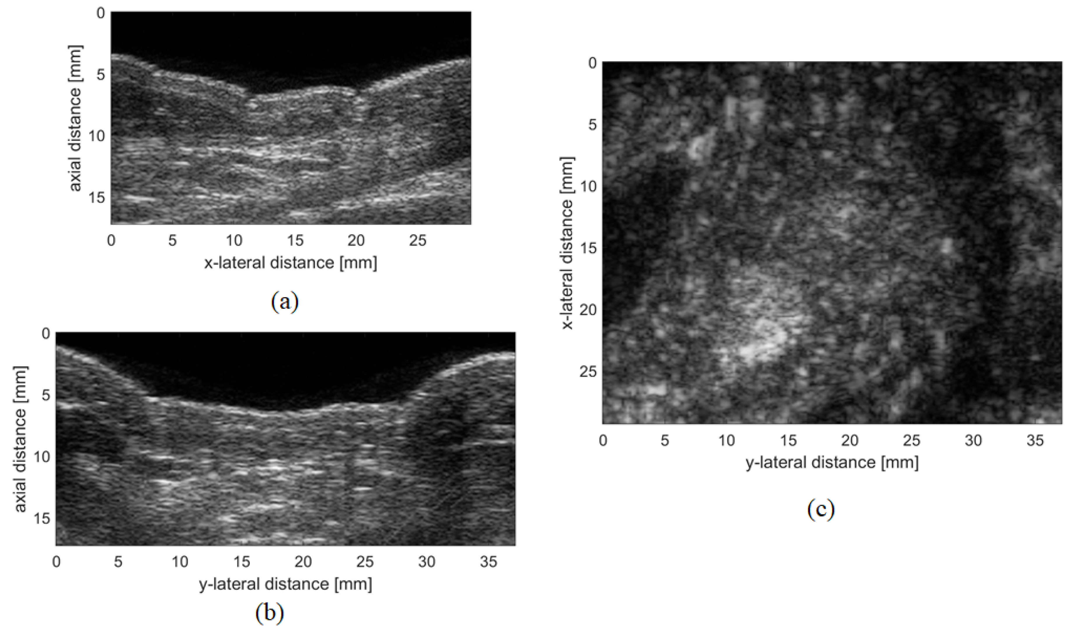 Sensors Free Full Text Ultrasound Systems For Biometric Recognition Html