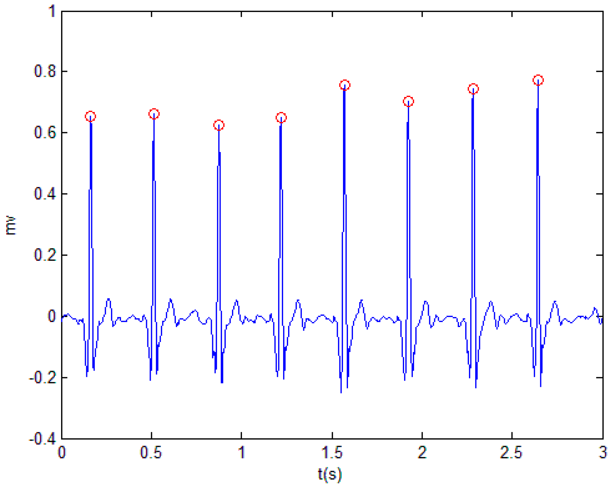 create a hypnogram matlab ecg