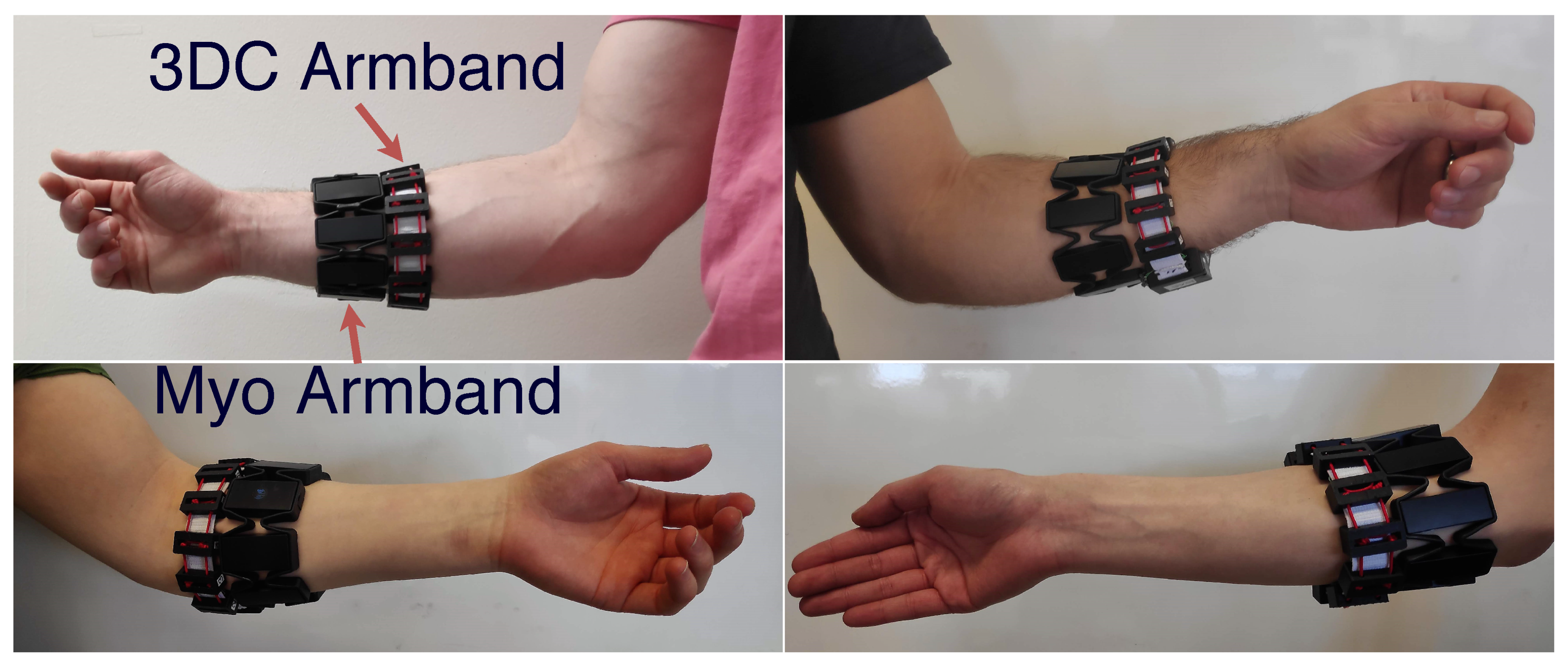 Sensors | Free Full-Text | A Low-Cost, Wireless, 3-D-Printed Custom Armband  for sEMG Hand Gesture Recognition