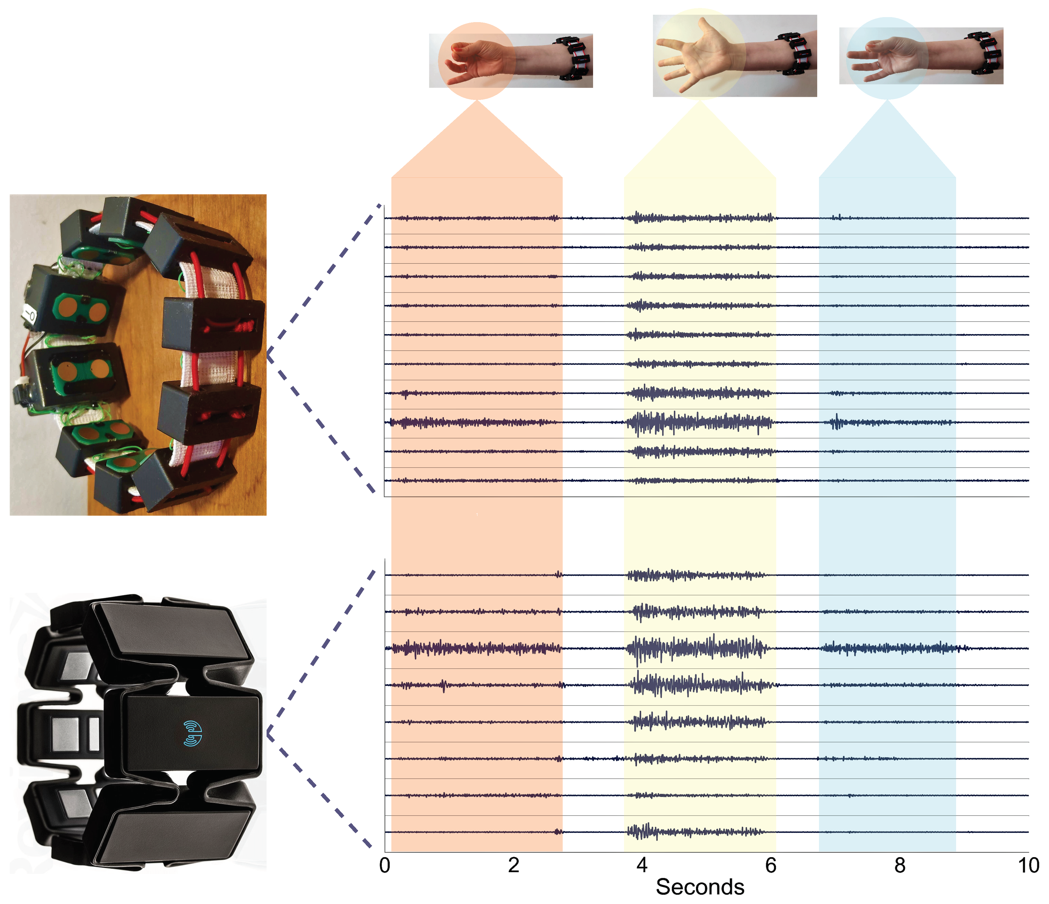 Sensors | Free Full-Text | A Low-Cost, Wireless, 3-D-Printed Custom Armband  for sEMG Hand Gesture Recognition | HTML