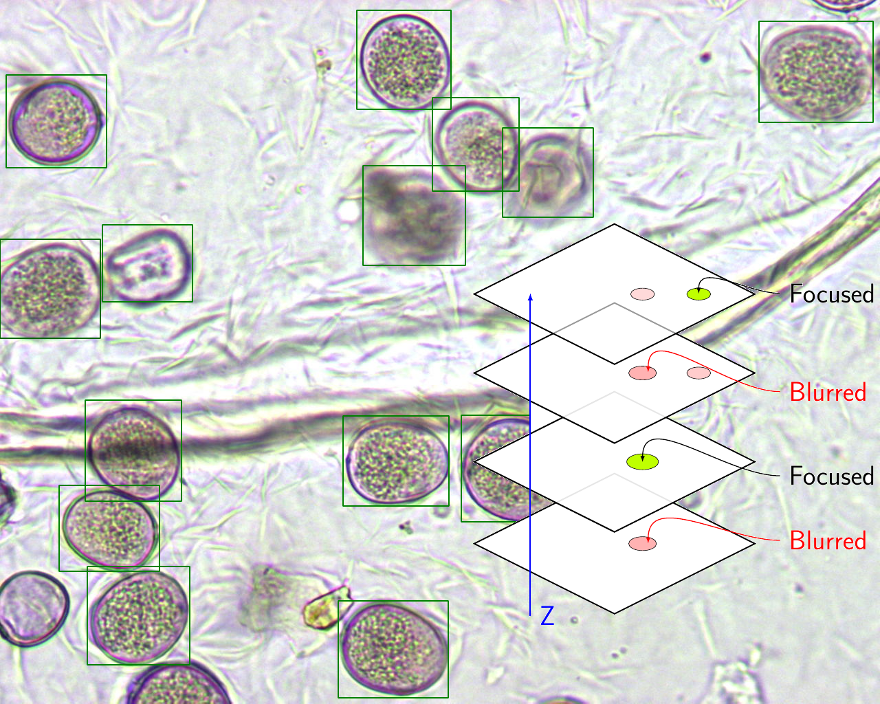 Sensors | Free Full-Text | Precise Pollen Grain Detection in Bright Field  Microscopy Using Deep Learning Techniques | HTML