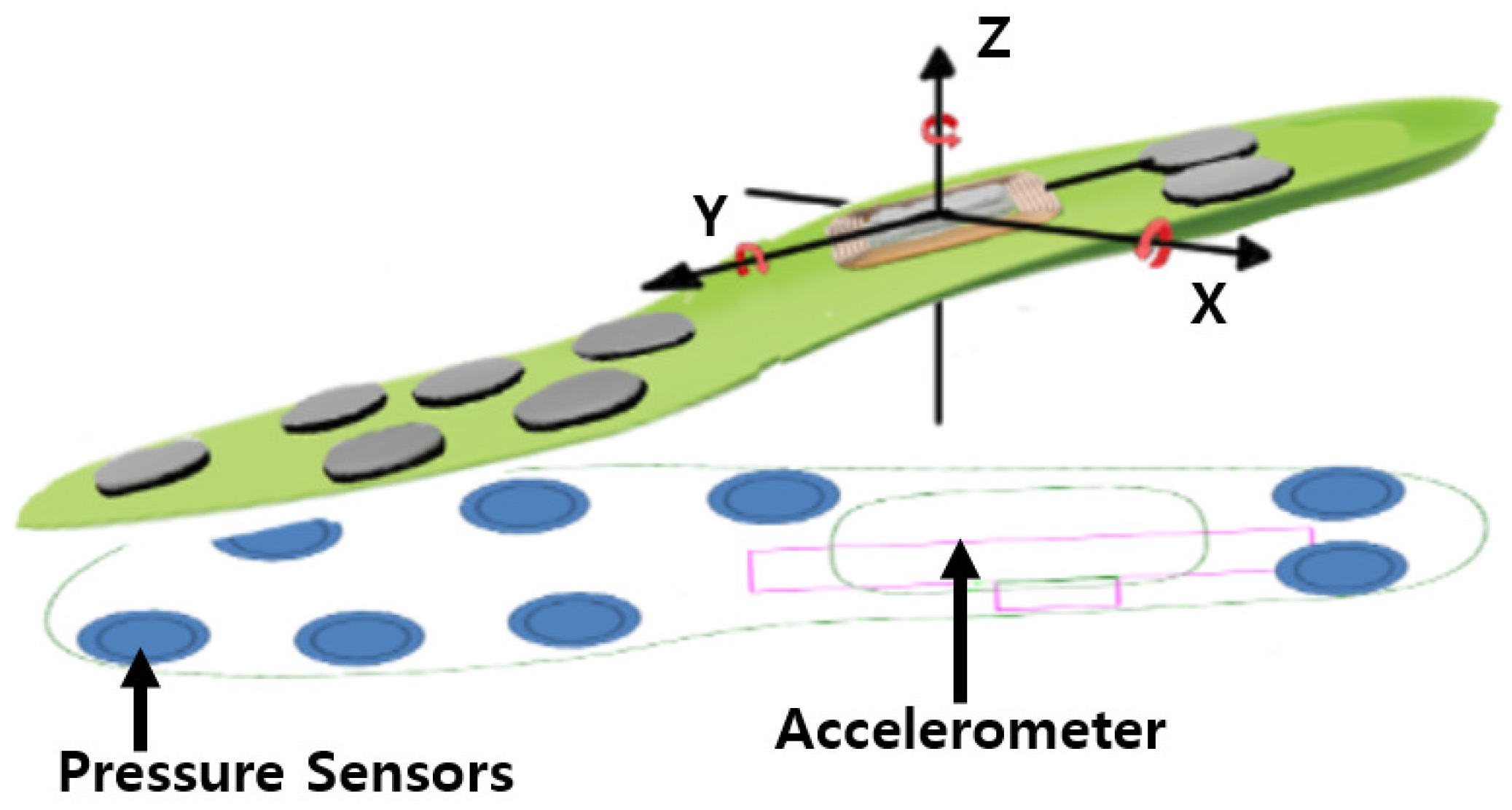 gait correction insoles