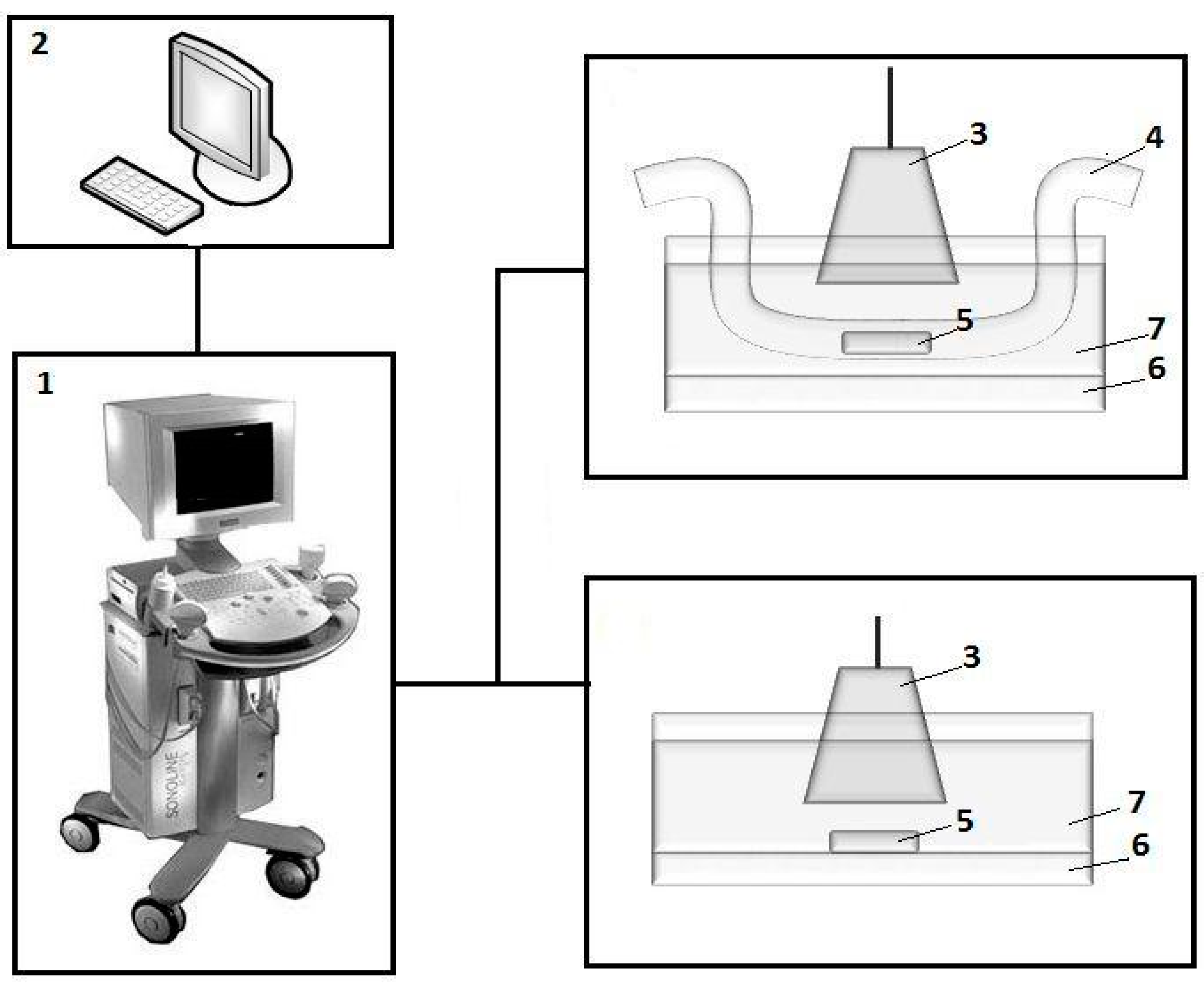 Sensors | Free Full-Text | Ferrogels Ultrasonography for Biomedical  Applications | HTML