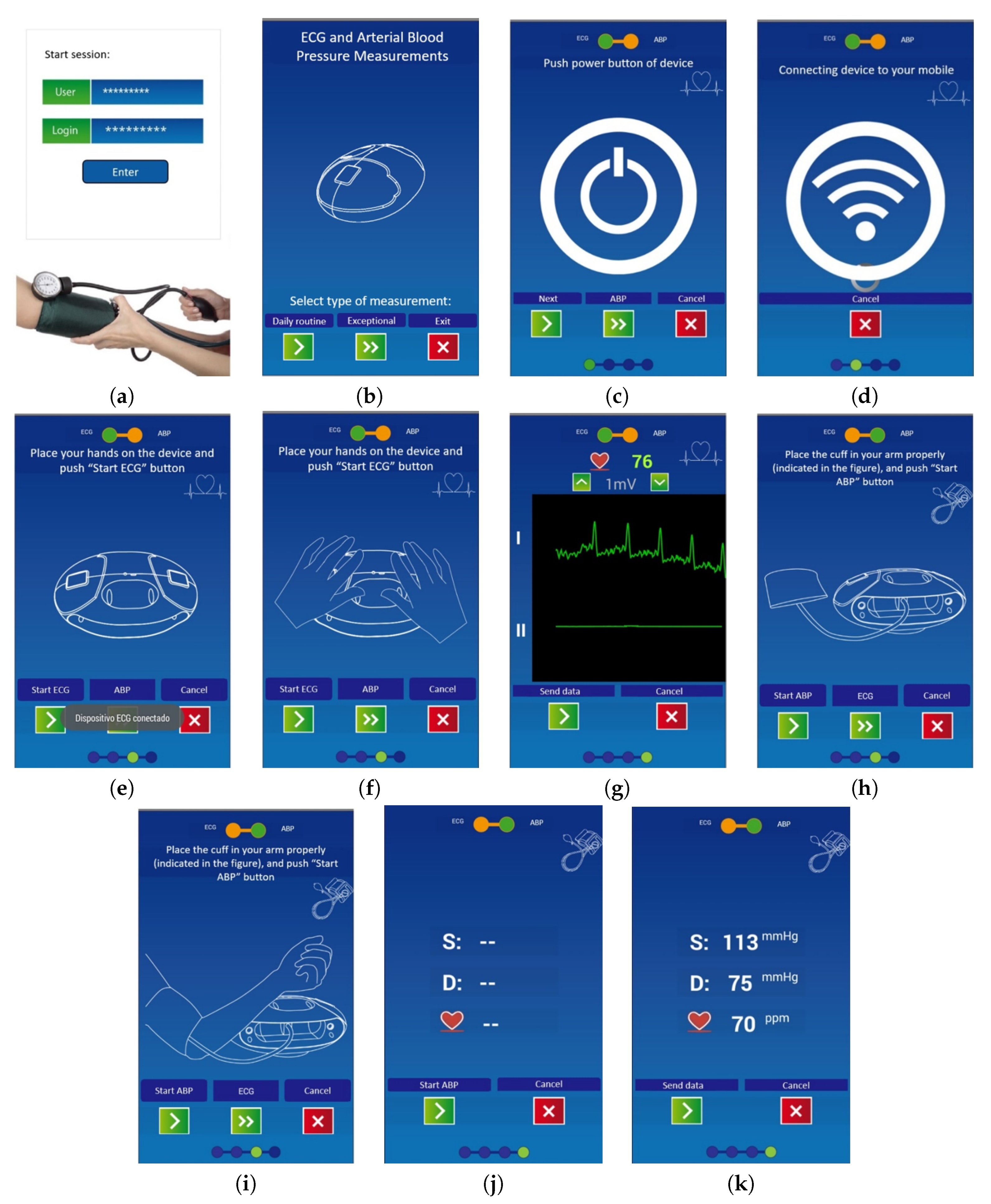 OMRON Healthcare Launches Breakthrough in Home ECG and Blood Pressure  Monitoring 