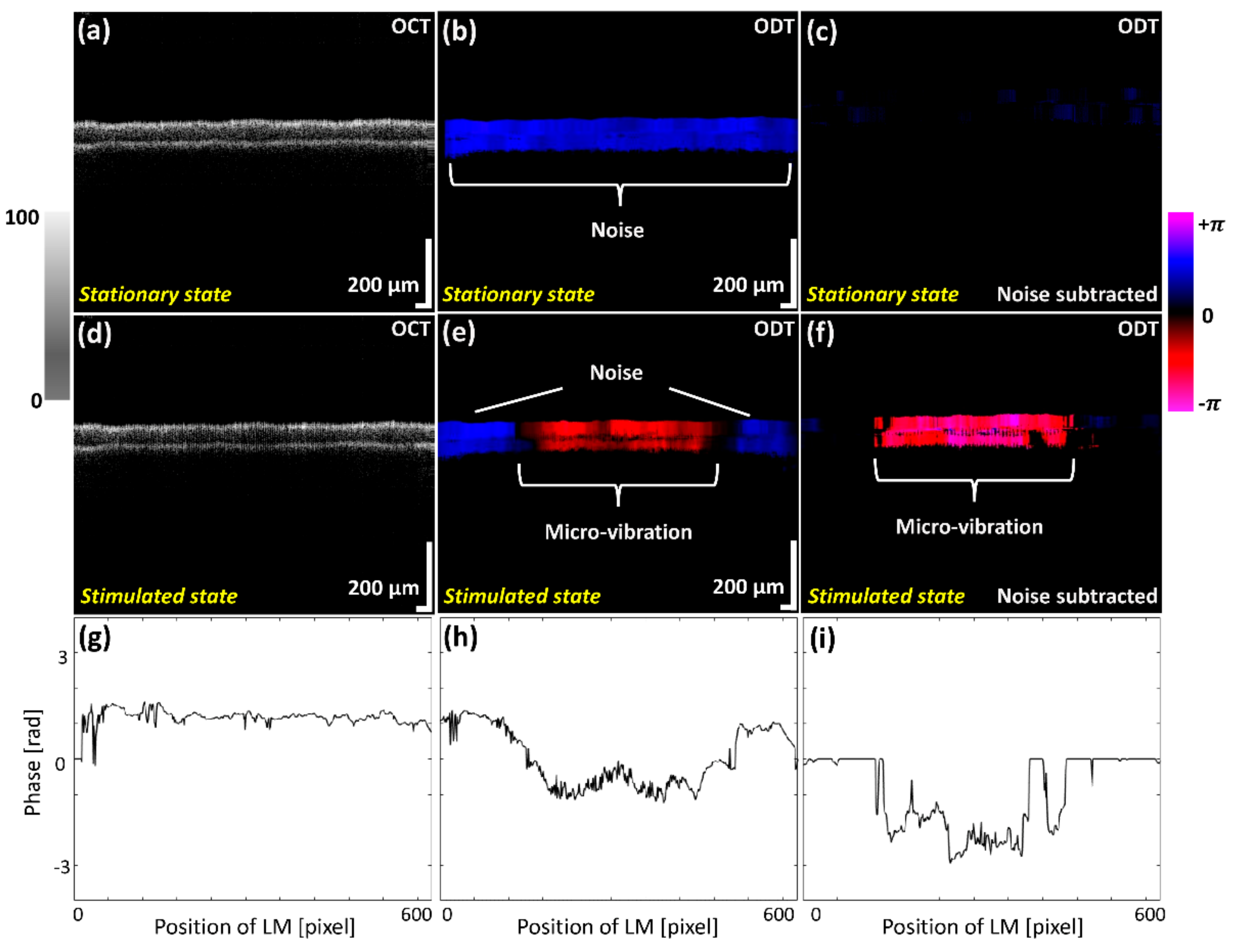 Sensors | Free Full-Text | In Situ Characterization of Micro-Vibration in  Natural Latex Membrane Resembling Tympanic Membrane Functionally Using  Optical Doppler Tomography