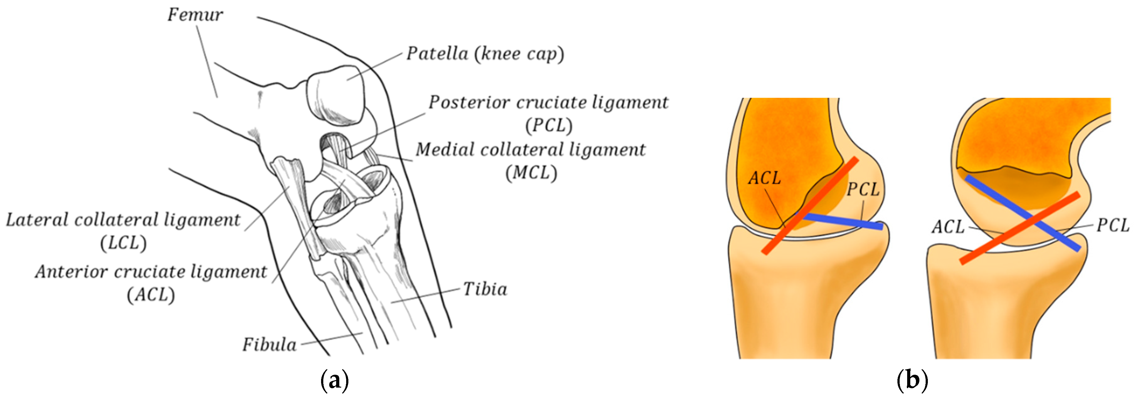 Medial Collateral Ligament (MCL) Tear Englewood