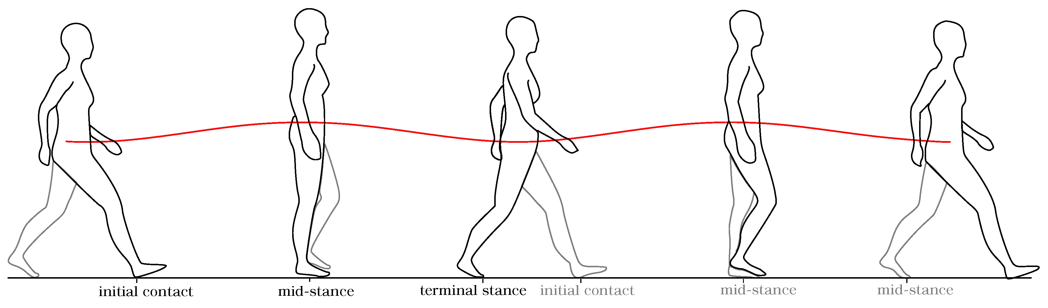 Sensors | Free Full-Text | Symmetry Analysis of Amputee Gait Based on ...