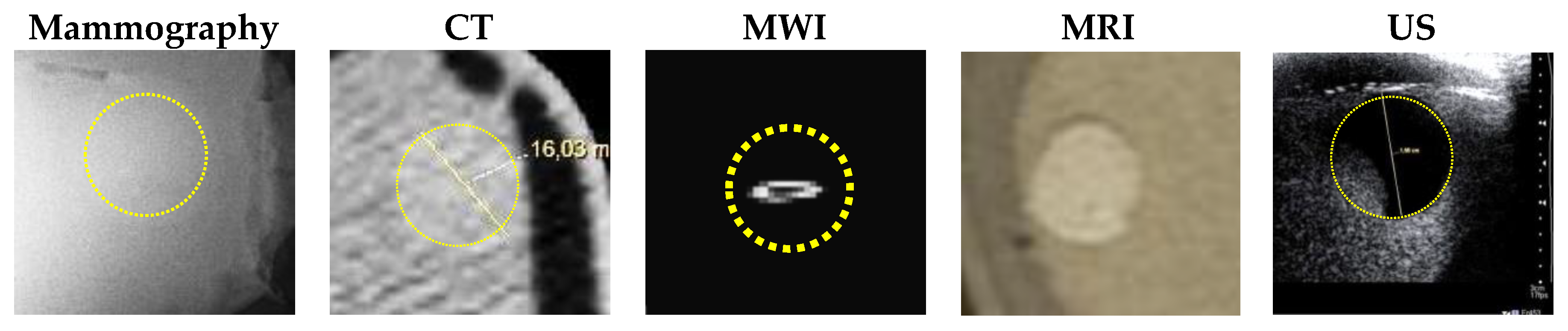 Sensors 20 02400 g012