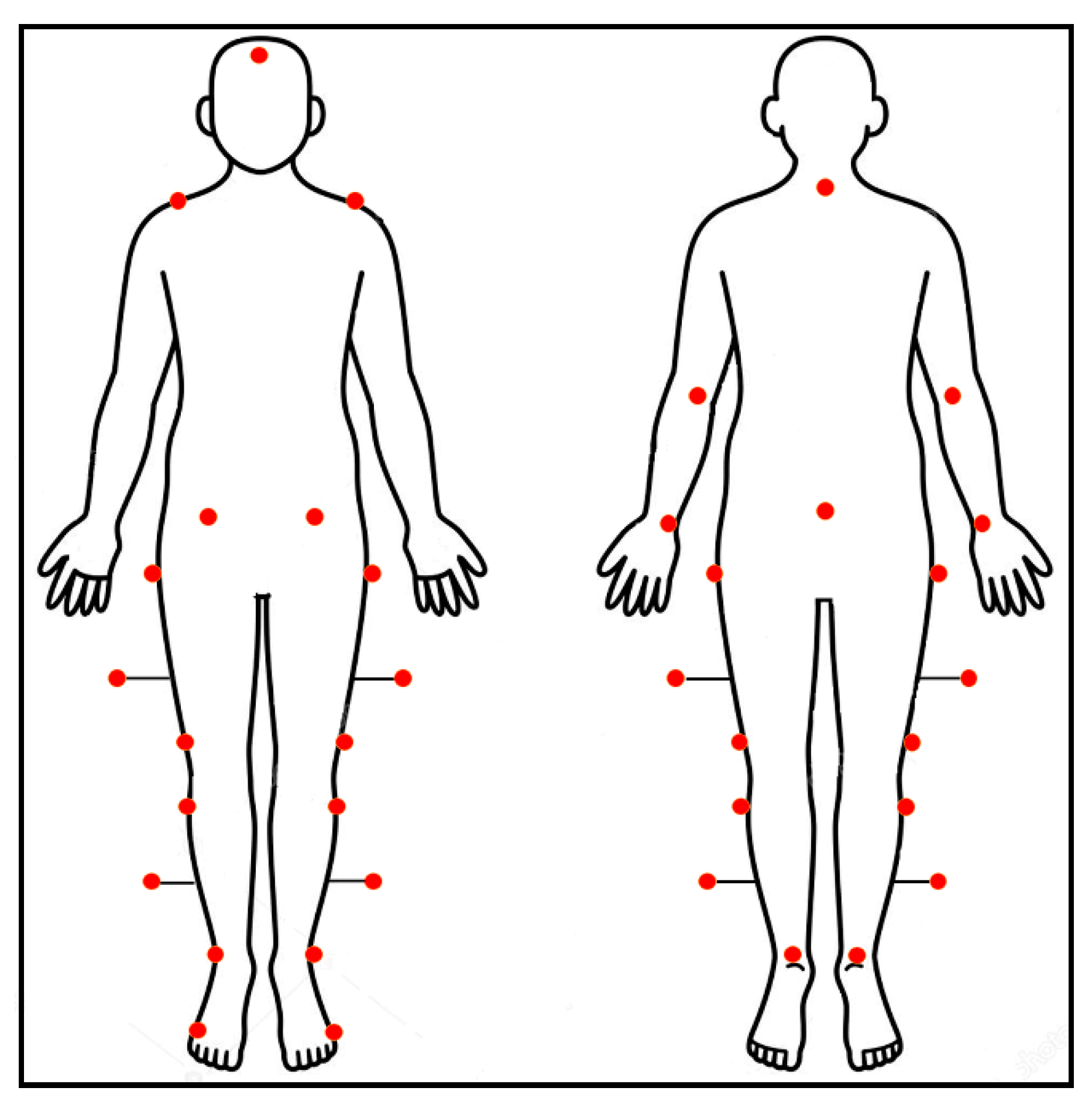 Sensors Free Full Text Global Muscle Coactivation Of The Sound Limb In Gait Of People With Transfemoral And Transtibial Amputation