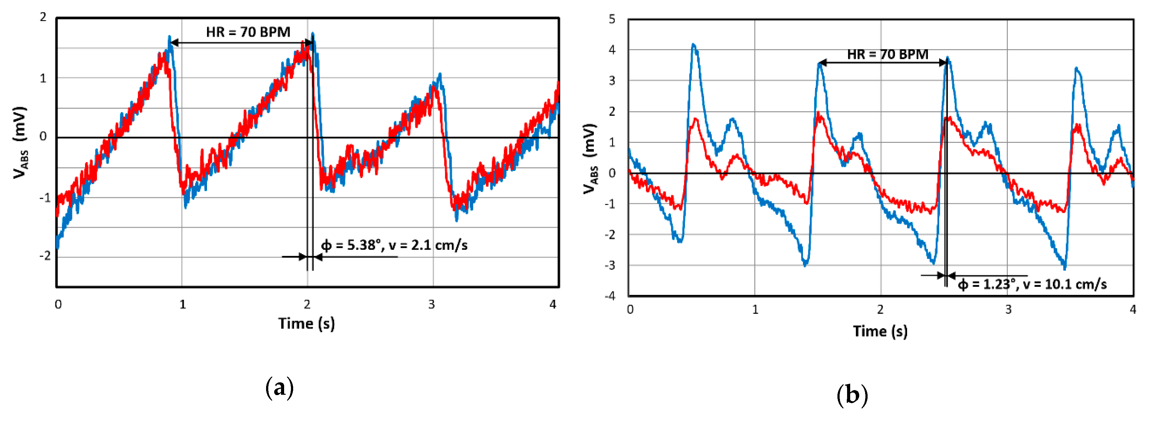 Sensors 20 02663 g011 Sensors 20 02663 g011