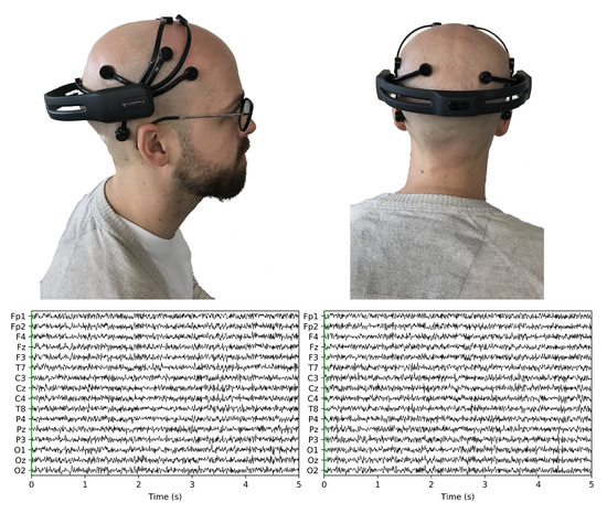 Sensors | Free Full-Text | Industry 4.0 Lean Shopfloor Management  Characterization Using EEG Sensors and Deep Learning | HTML