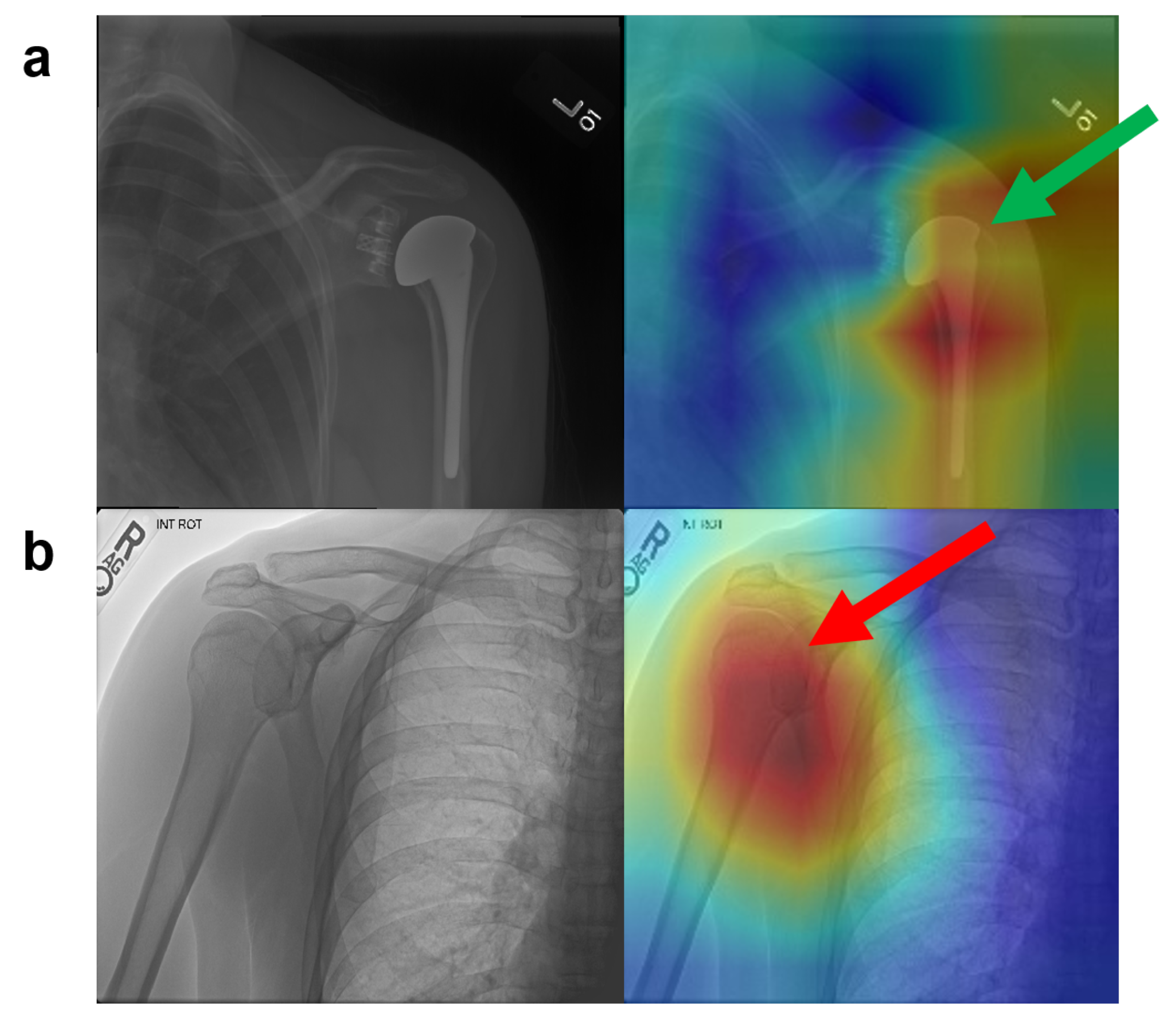 Sensors 20 03153 g005 Sensors 20 03153 g005