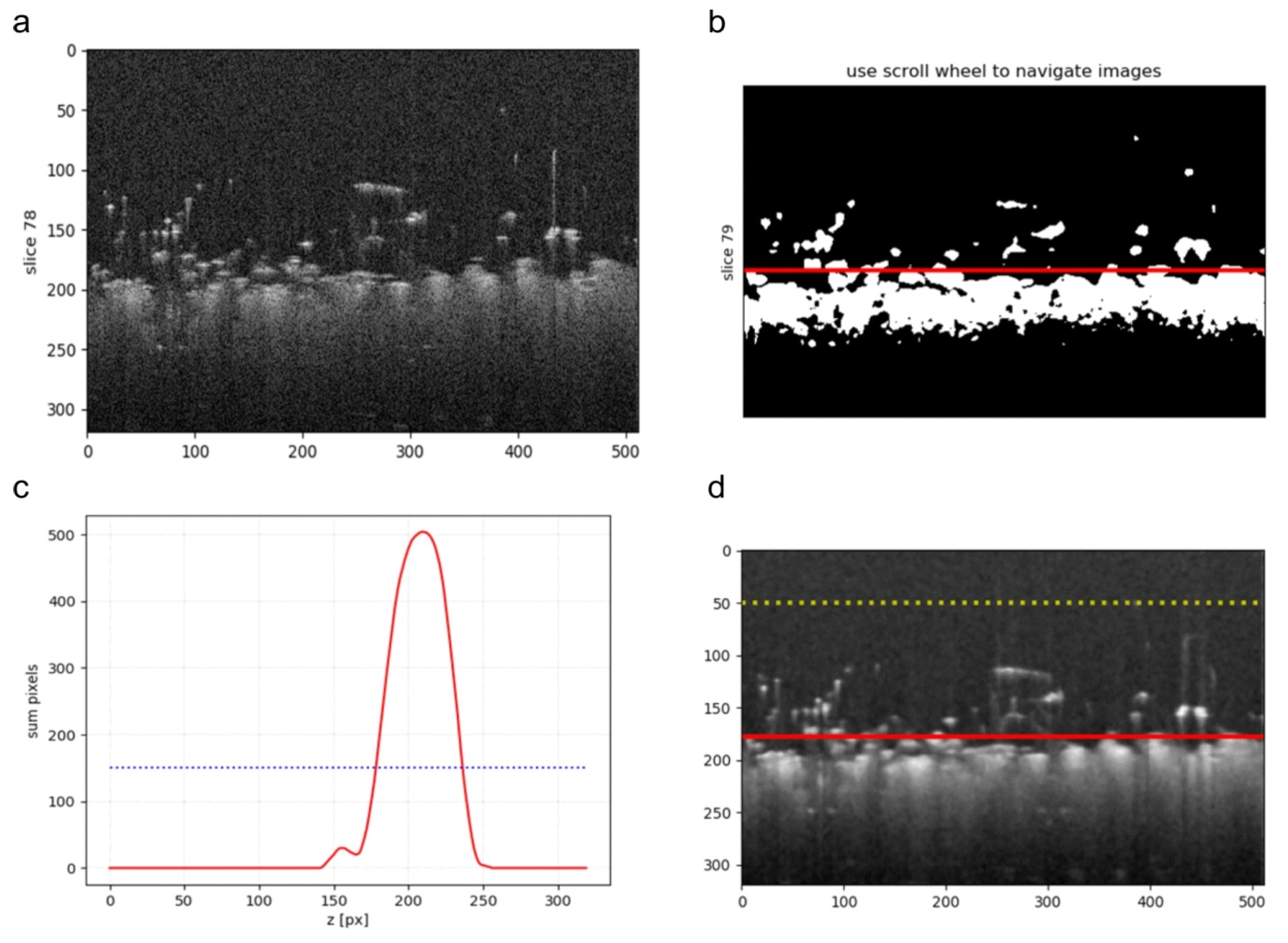 Sensors Free Full Text A Method For The Assessment Of Textile Pilling Tendency Using Optical Coherence Tomography Html