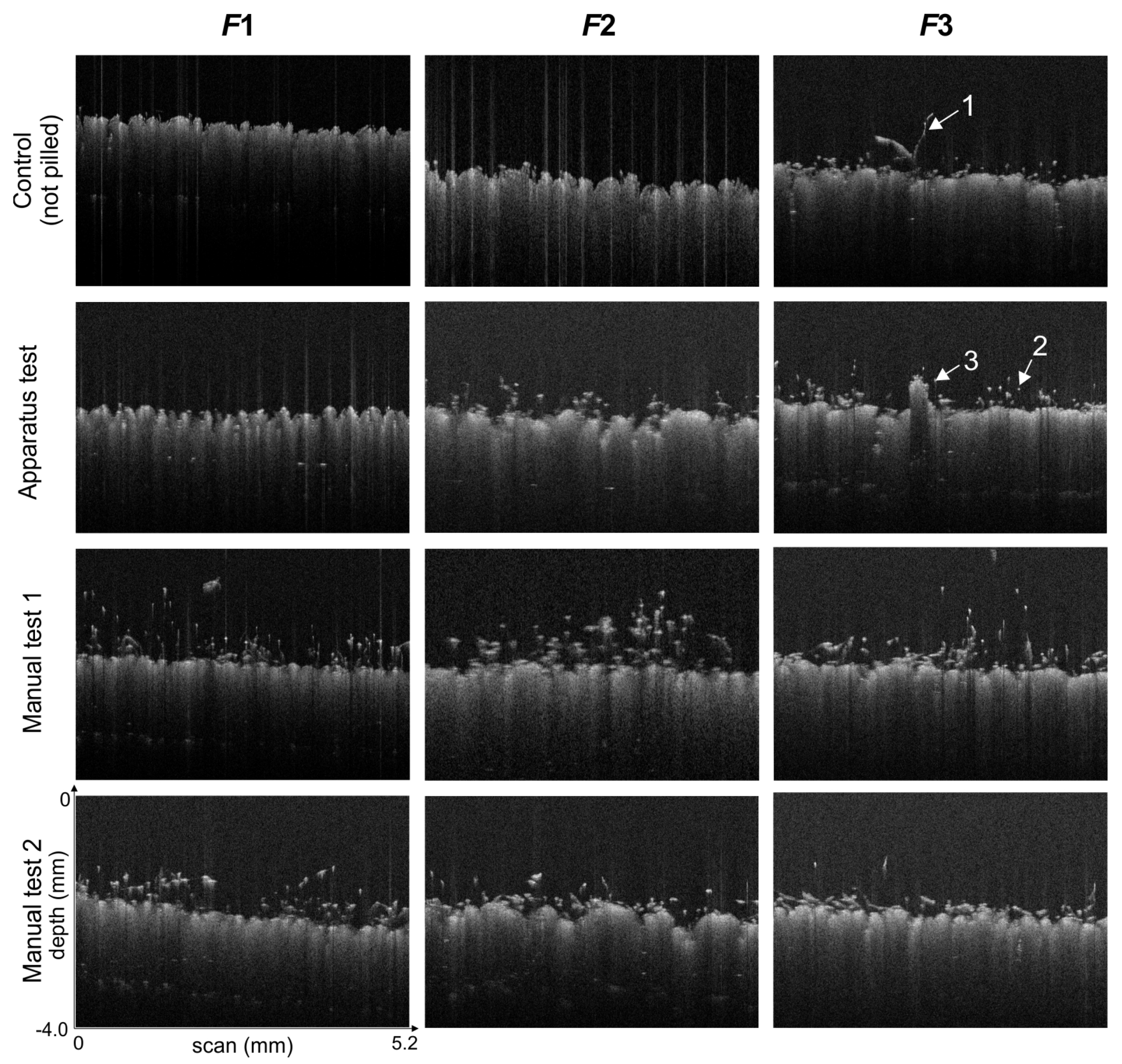 Sensors Free Full Text A Method For The Assessment Of Textile Pilling Tendency Using Optical Coherence Tomography Html