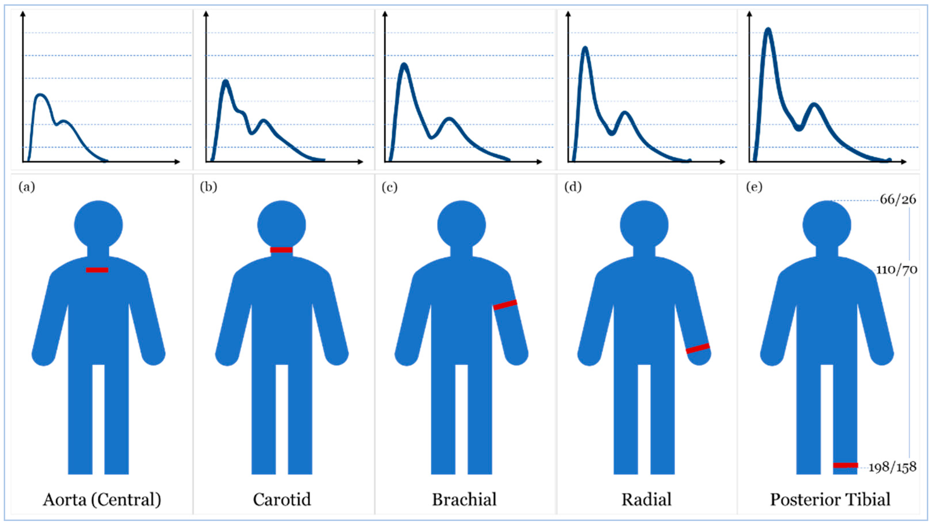 find the sensors for blood pressure