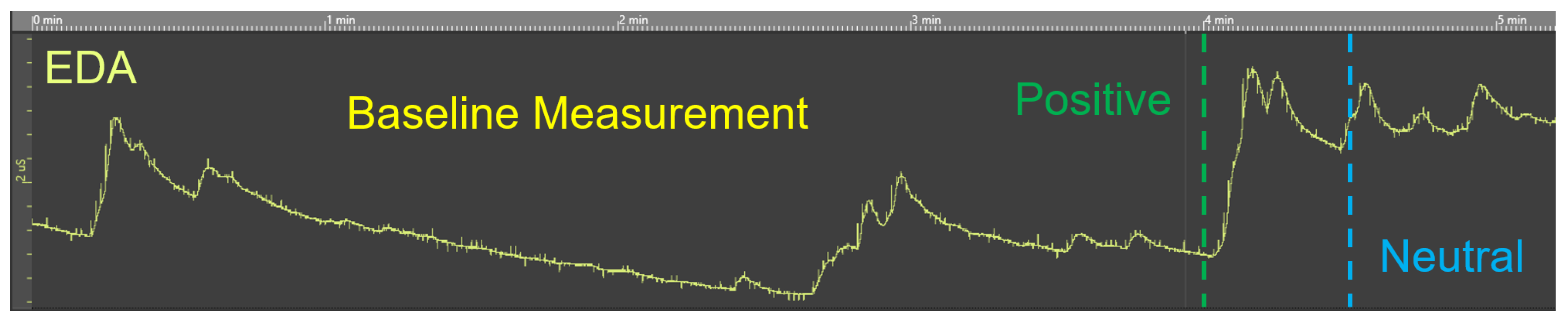 Sensors 20 04561 g005