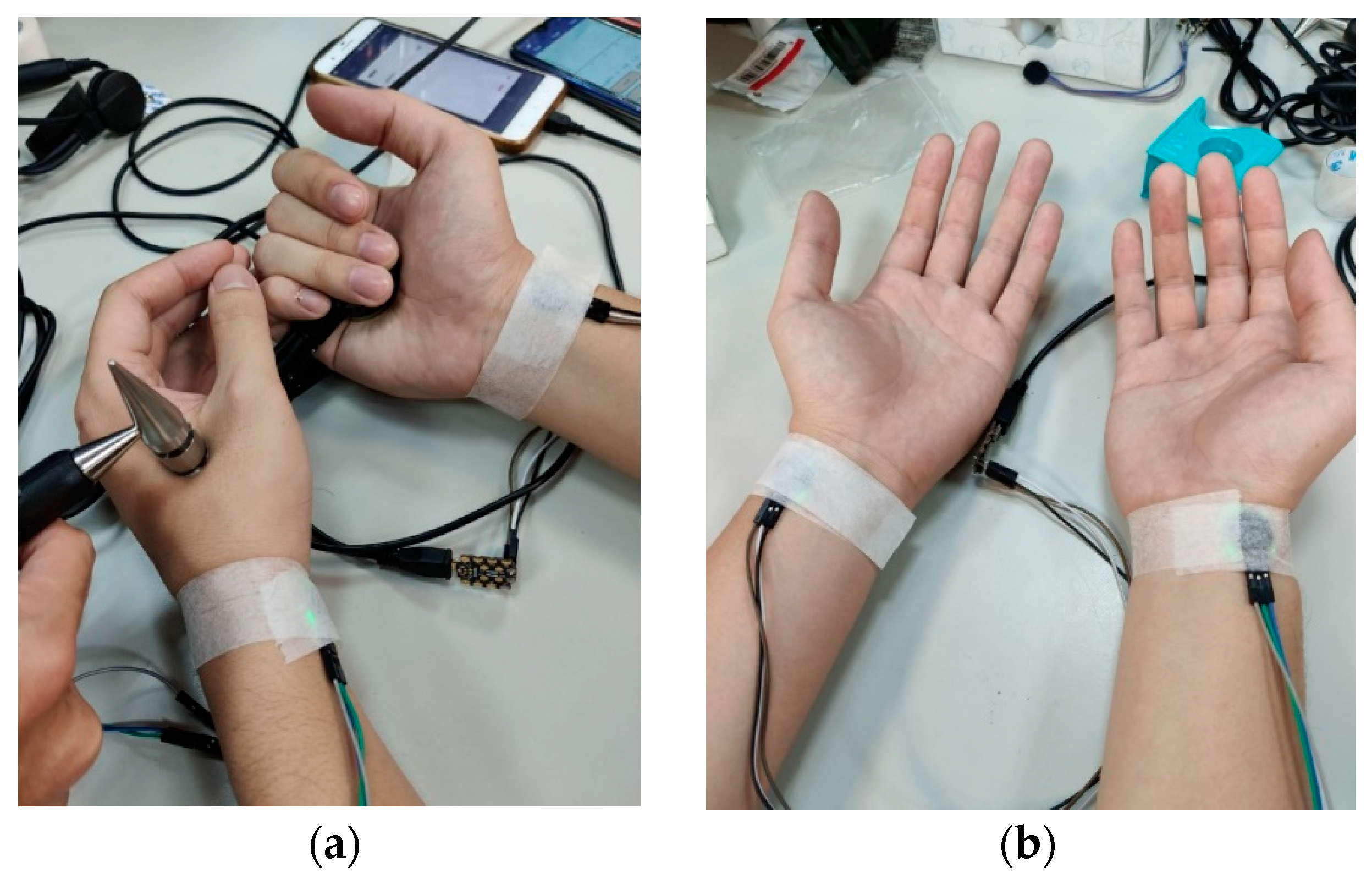 Sensors | Free Full-Text | Traditional Chinese Medicine Pulse Diagnosis on  a Smartphone Using Skin Impedance at Acupoints: A Feasibility Study