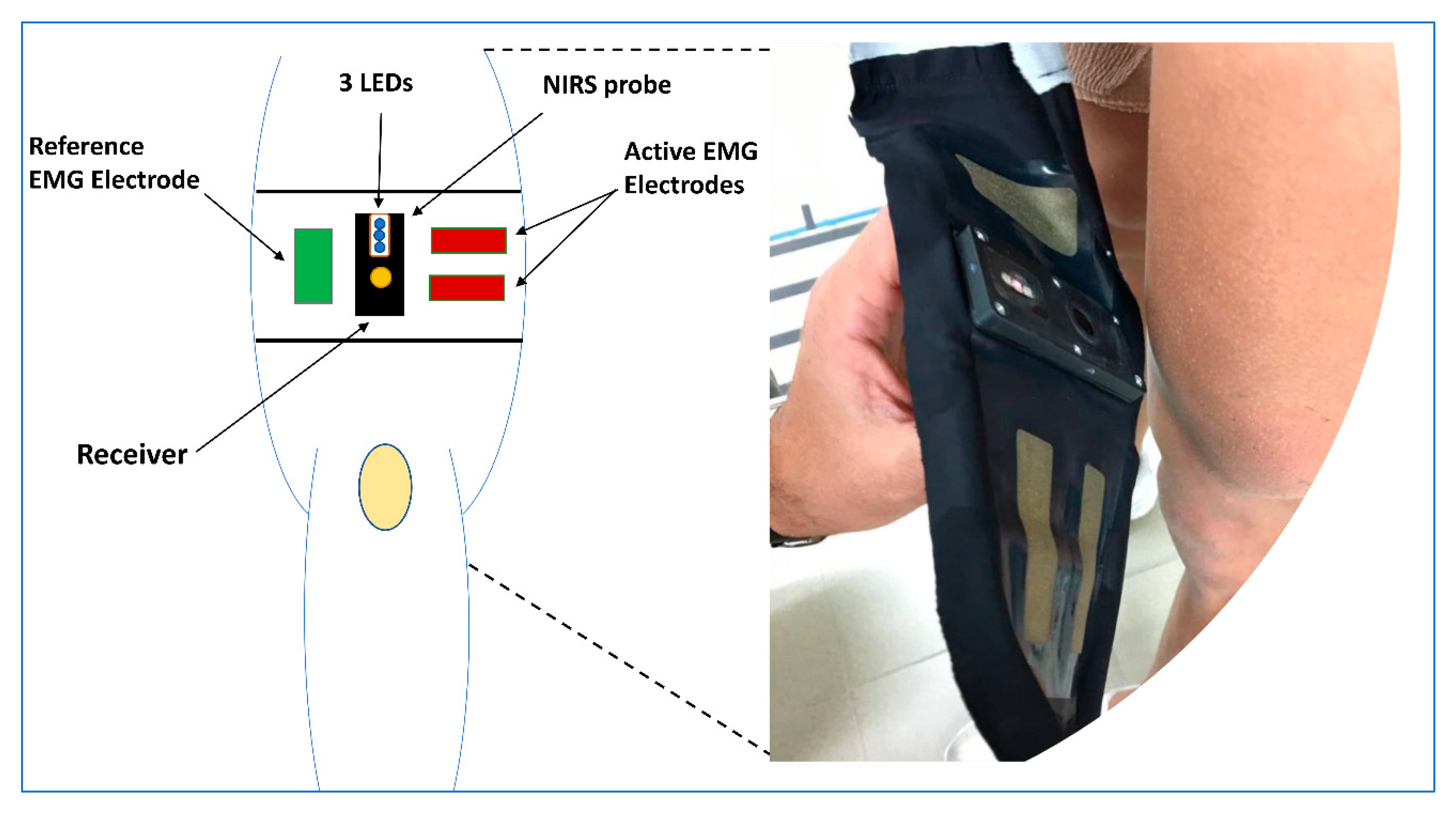 Sensors | Free Full-Text | Validation of Fabric-Based Thigh-Wearable EMG  Sensors and Oximetry for Monitoring Quadriceps Activity during Strength and  Endurance Exercises