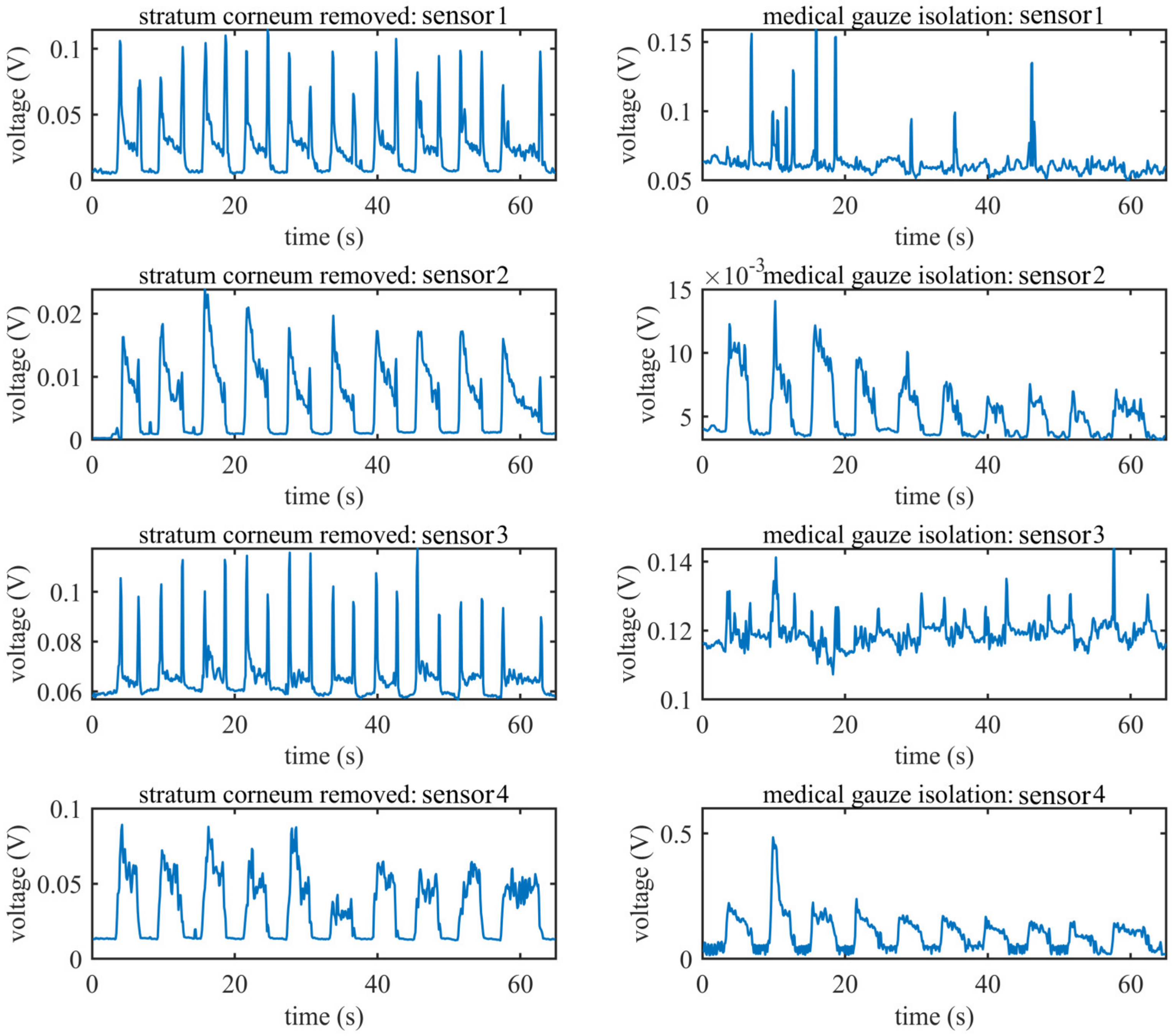 Sensors 20 04775 g011