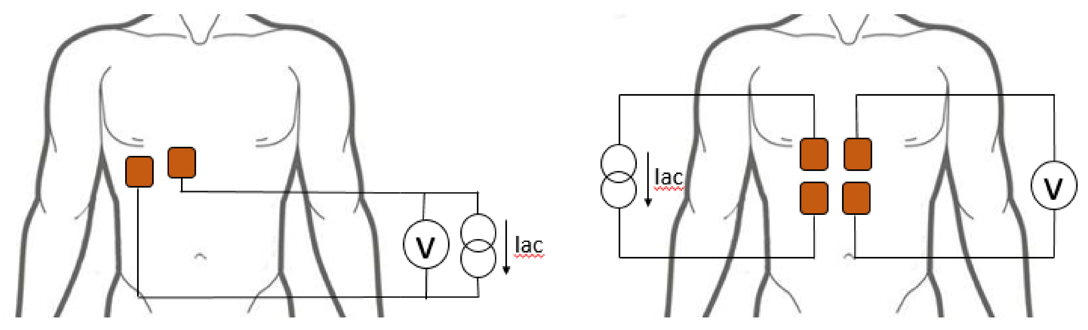 Sensors 20 05228 g001 Sensors 20 05228 g001