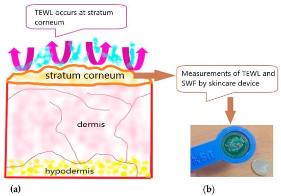 Sensors | Free Full-Text | Monitoring Transepidermal Water Loss and Skin  Wettedness Factor with Battery-Free NFC Sensor