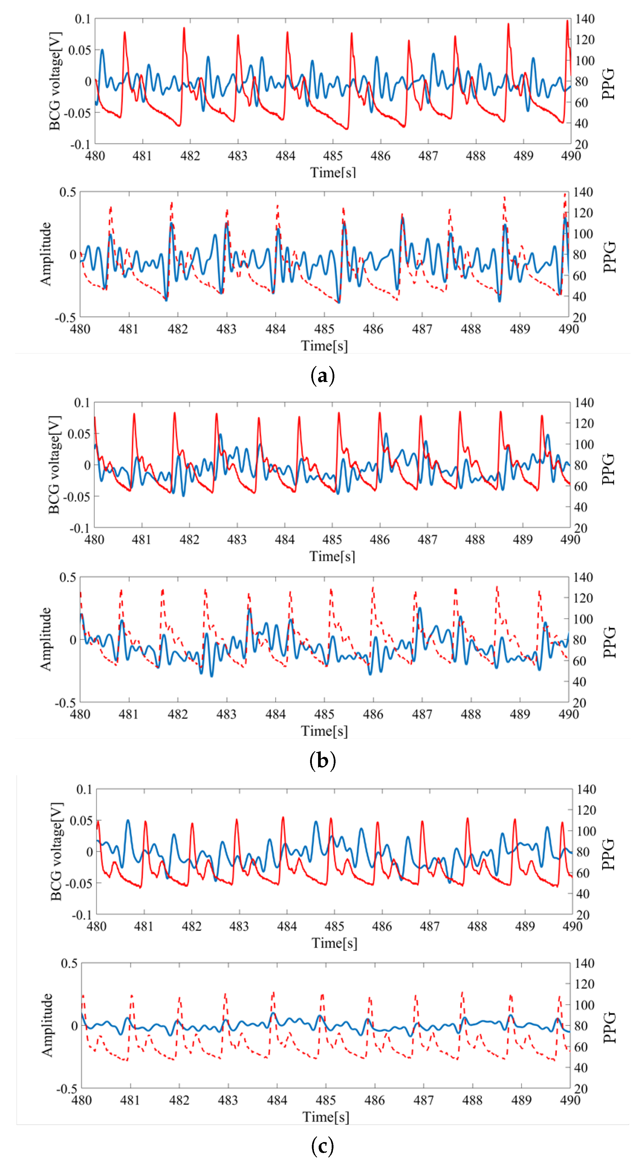 Sensors Free Full Text Sleep Stage Estimation From Bed Leg Ballistocardiogram Sensors Html