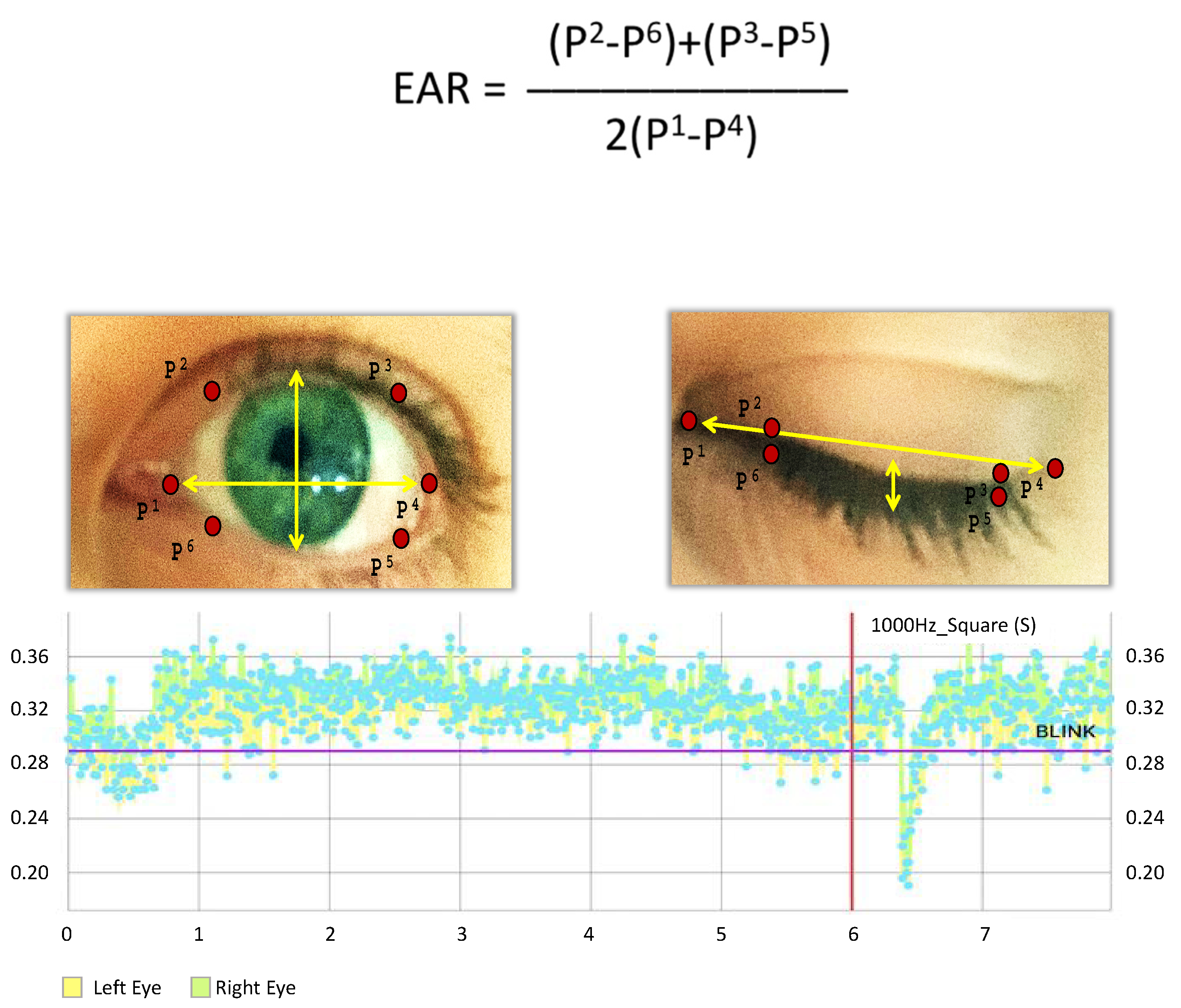 Sensors | Free Full-Text | EMG-Free Monitorization of the Acoustic Startle  Reflex with a Mobile Phone: Implications of Sound Parameters with Posture  Related Responses