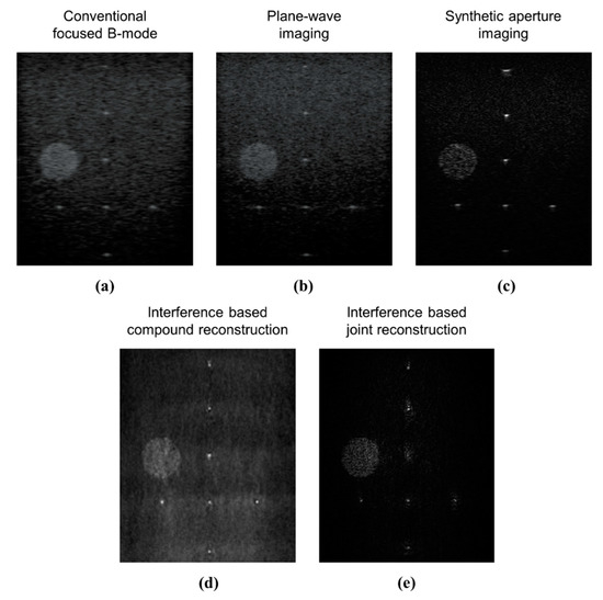 Ultrasound B-Mode Image Reconstruction 