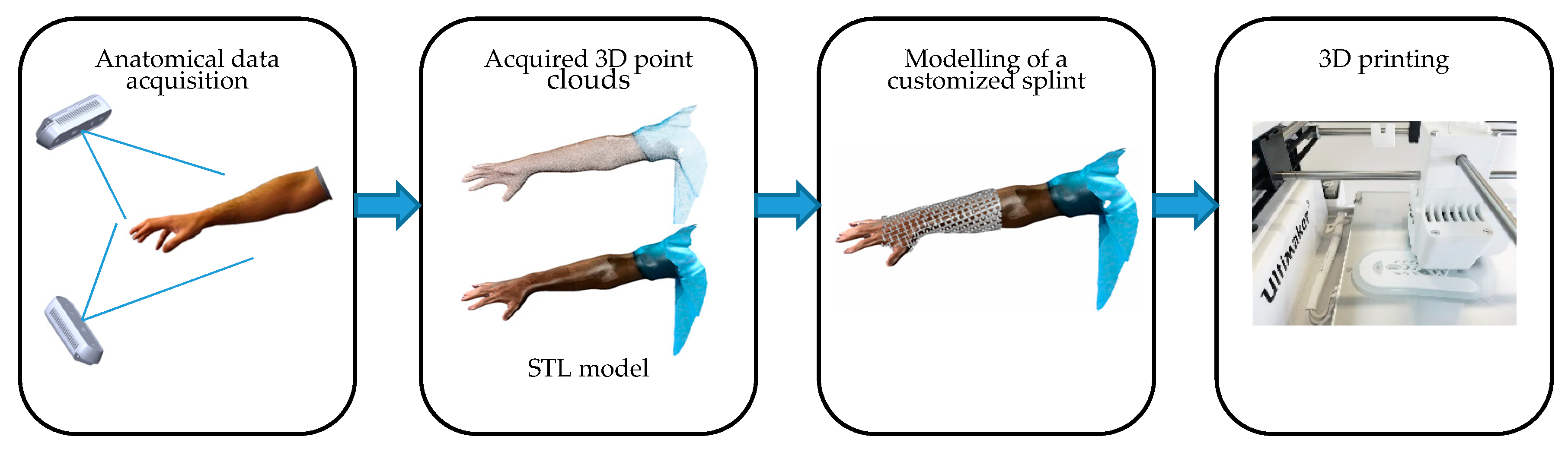 Sensors | Free Full-Text | Sensor Architectures and Technologies for Upper  Limb 3D Surface Reconstruction: A Review