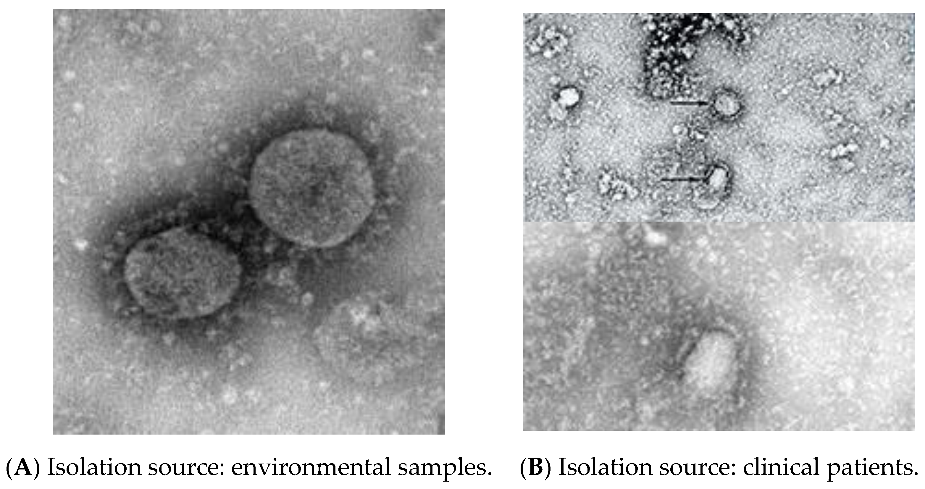 Sensors Free Full Text An Analysis Review Of Detection Coronavirus Disease 19 Covid 19 Based On Biosensor Application Html