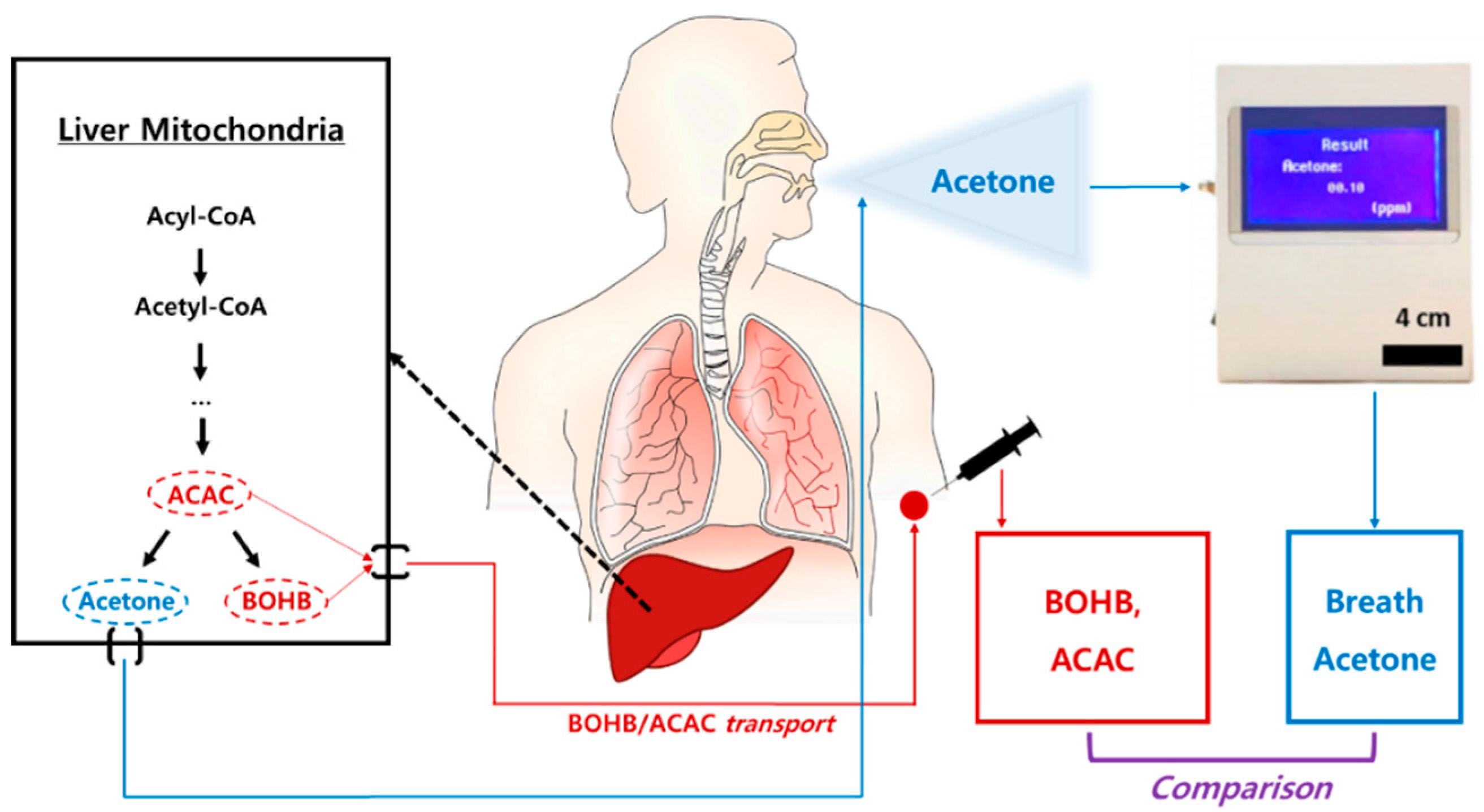 Sensors | Free Full-Text | Breath Acetone Measurement-Based Prediction of  Exercise-Induced Energy and Substrate Expenditure