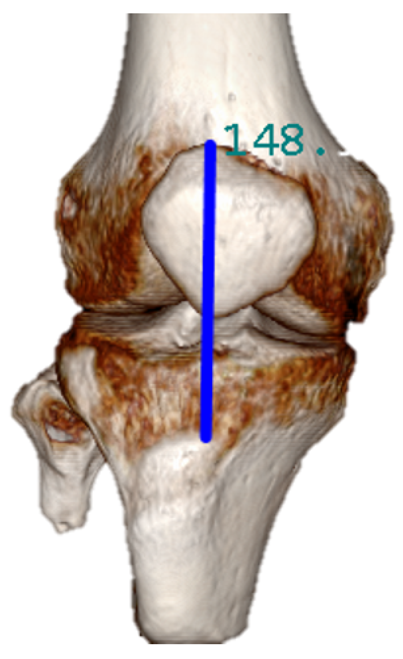 Sensors 20 07043 g009