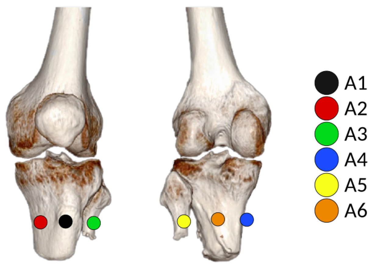 Sensors 20 07043 g018