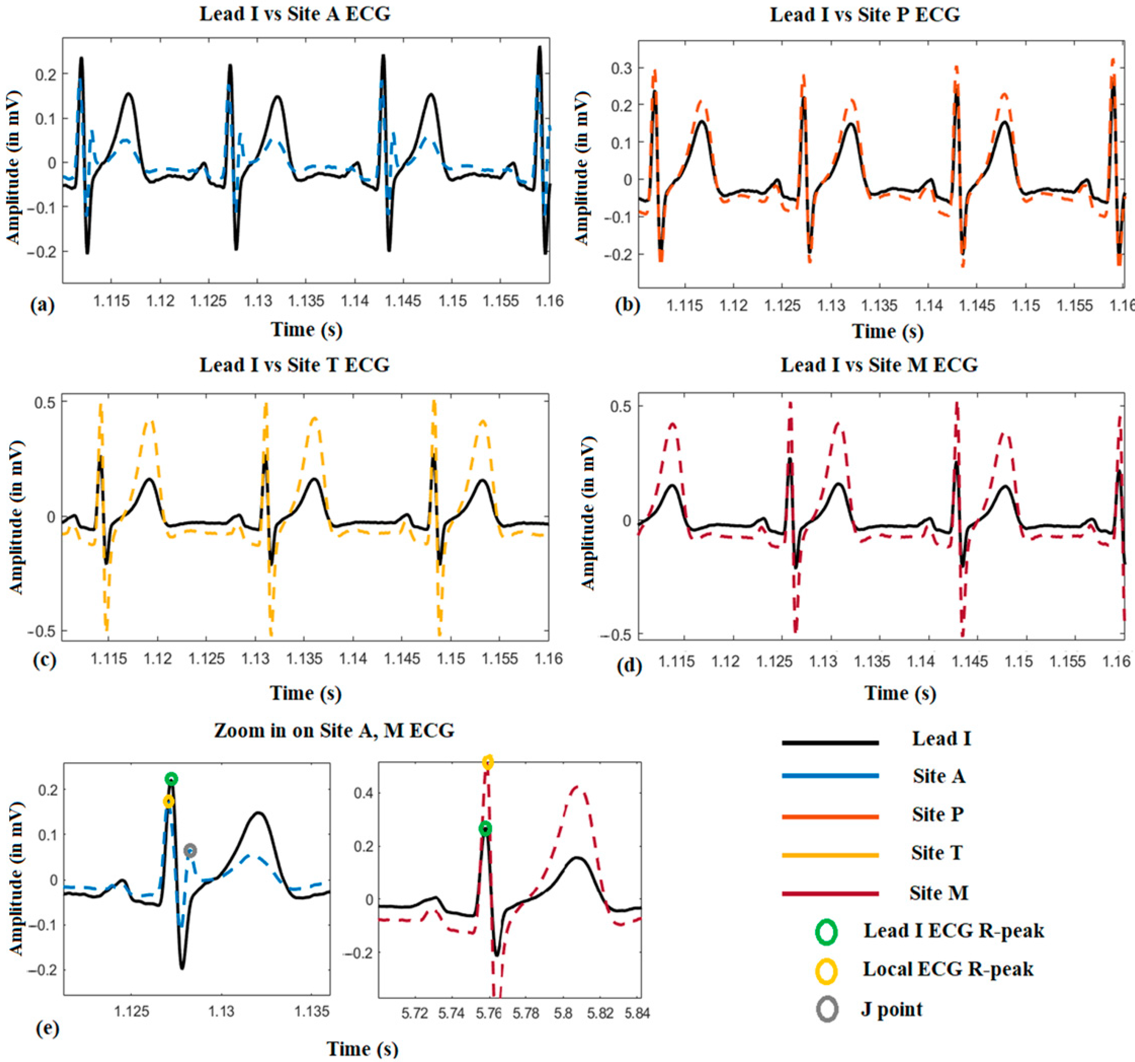 Sensors | Free Full-Text | Estimation of the Respiratory Rate from  Localised ECG at Different Auscultation Sites