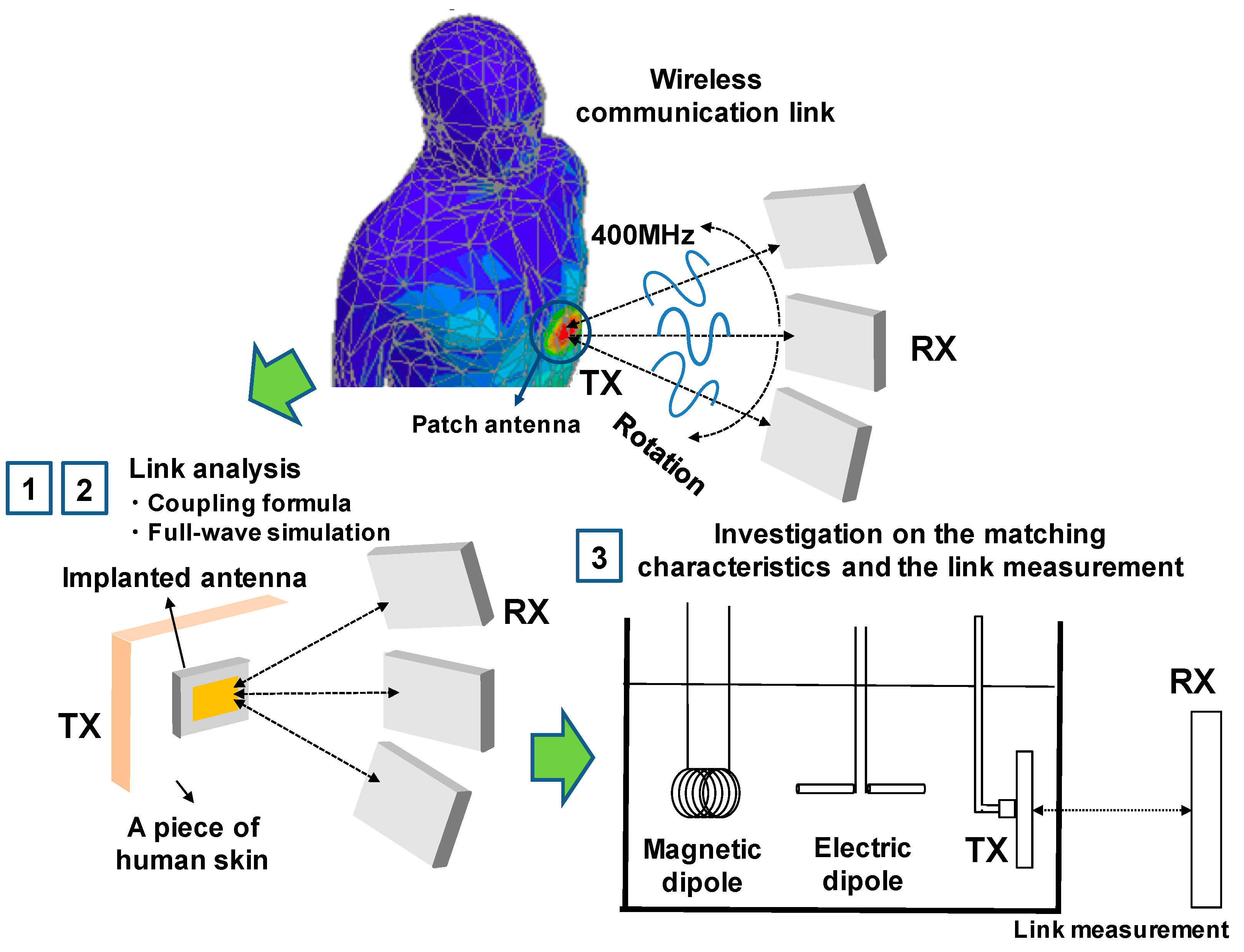 Sensors | Free Full-Text | Investigation on Wireless Link for Medical  Telemetry Including Impedance Matching of Implanted Antennas