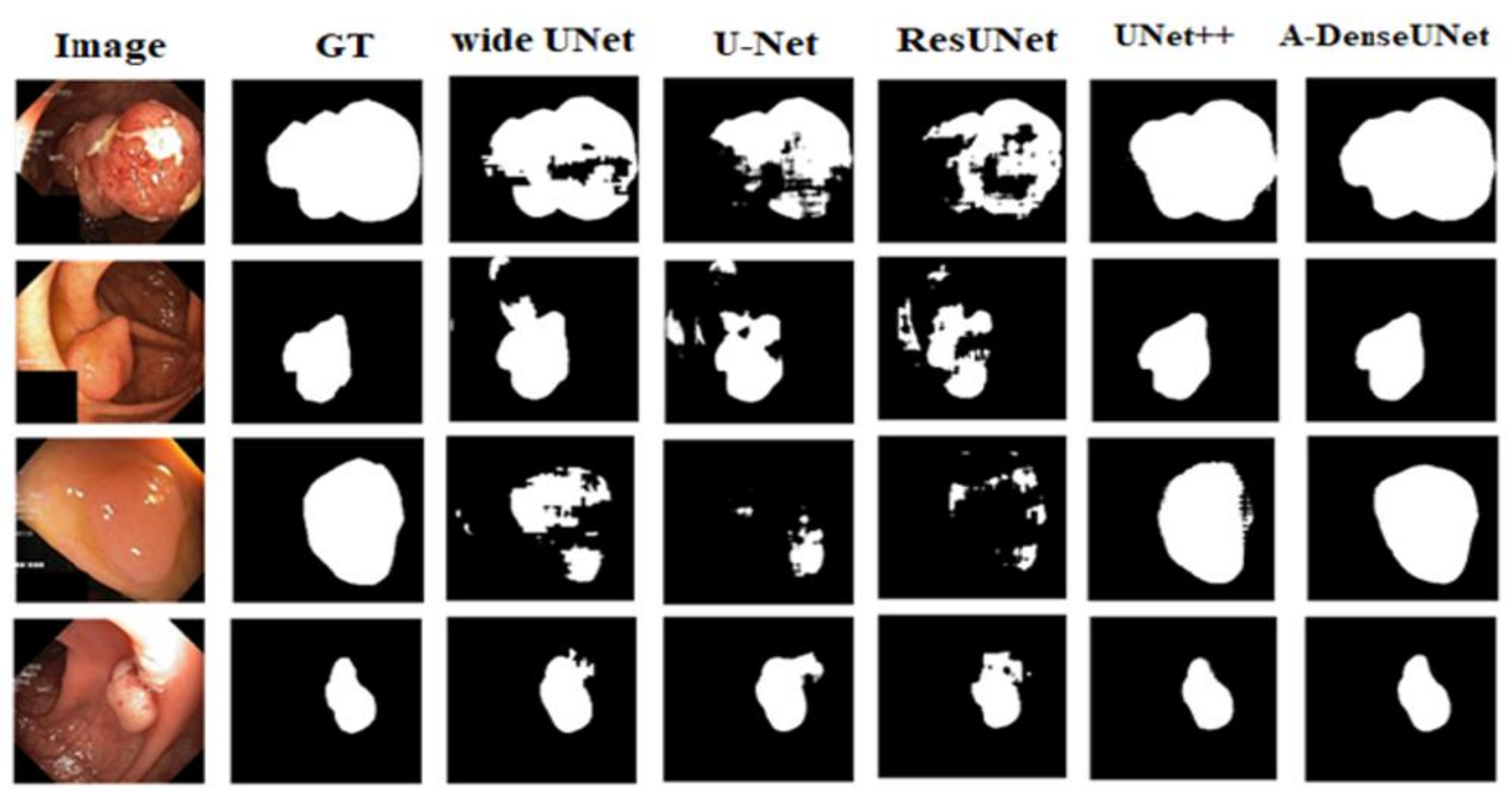 Sensors Free Full Text A Denseunet Adaptive Densely Connected Unet For Polyp Segmentation In Colonoscopy Images With Atrous Convolution Html