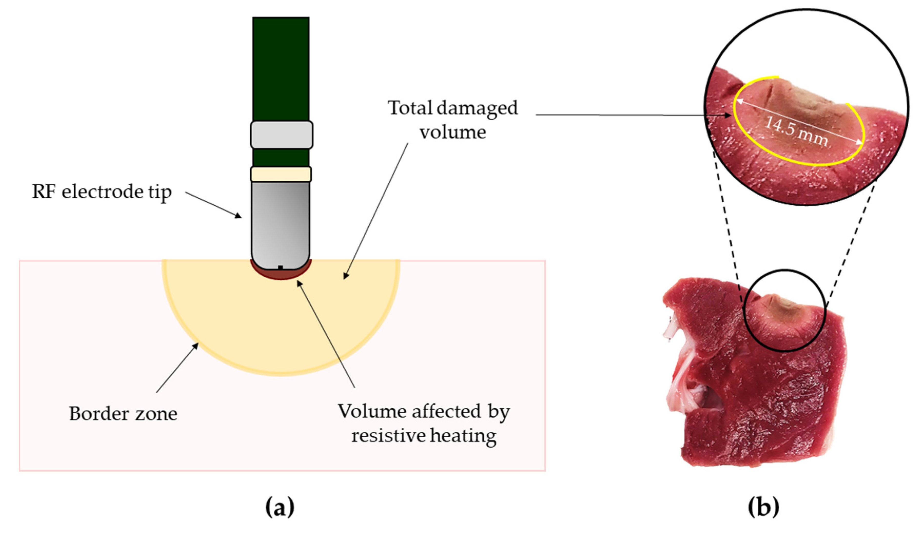 Sensors | Free Full-Text | Techniques for Temperature Monitoring of  Myocardial Tissue Undergoing Radiofrequency Ablation Treatments: An Overview