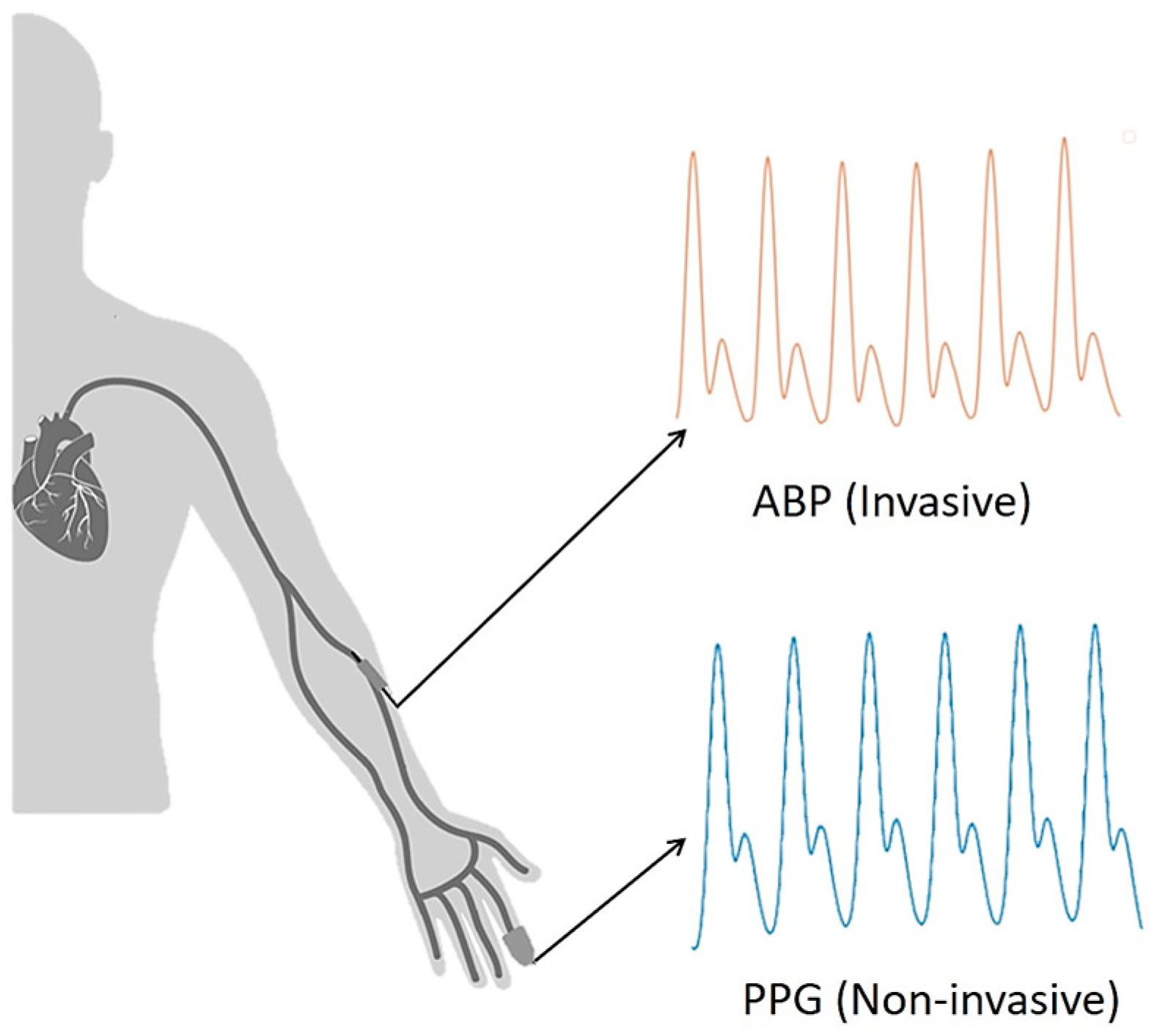 Sensors | Free Full-Text | An Estimation Method of Continuous Non-Invasive Arterial  Blood Pressure Waveform Using Photoplethysmography: A U-Net  Architecture-Based Approach