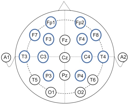 Sensors | Free Full-Text | EEG-Based Sleep Staging Analysis with ...