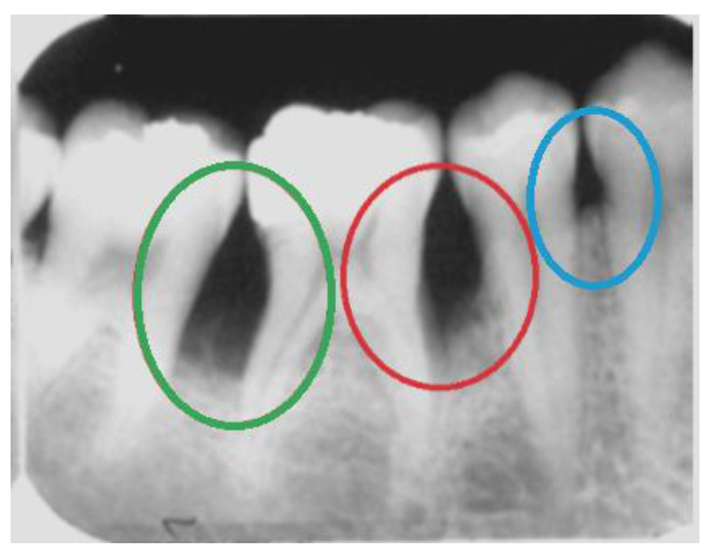Sensors | Free Full-Text | Do Radiographic Assessments of Periodontal Bone  Loss Improve with Deep Learning Methods for Enhanced Image Resolution?