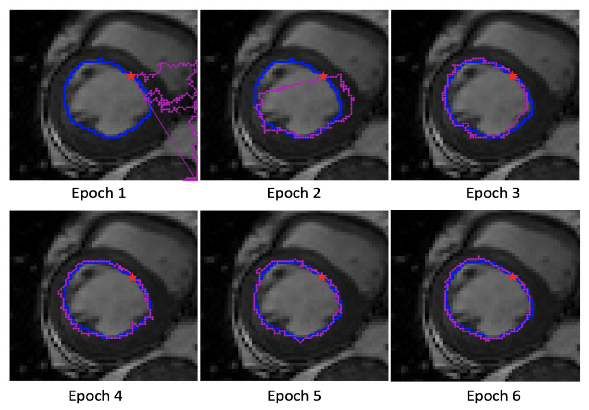 Segmentation by Active Contours. Left: Manually specified contour.