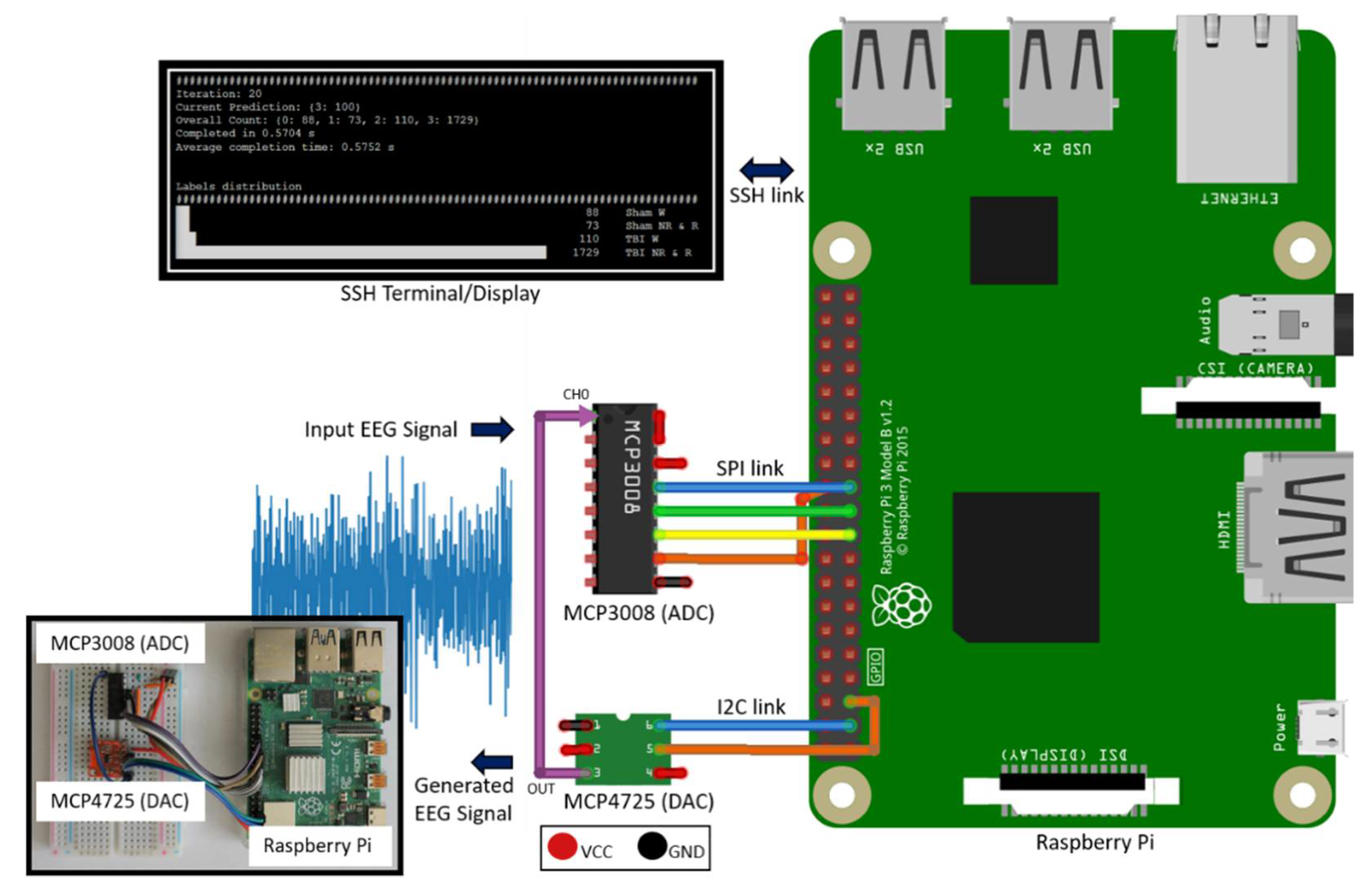 Sensors | Free Full-Text | A Raspberry Pi-Based Traumatic Brain Injury  Detection System for Single-Channel Electroencephalogram