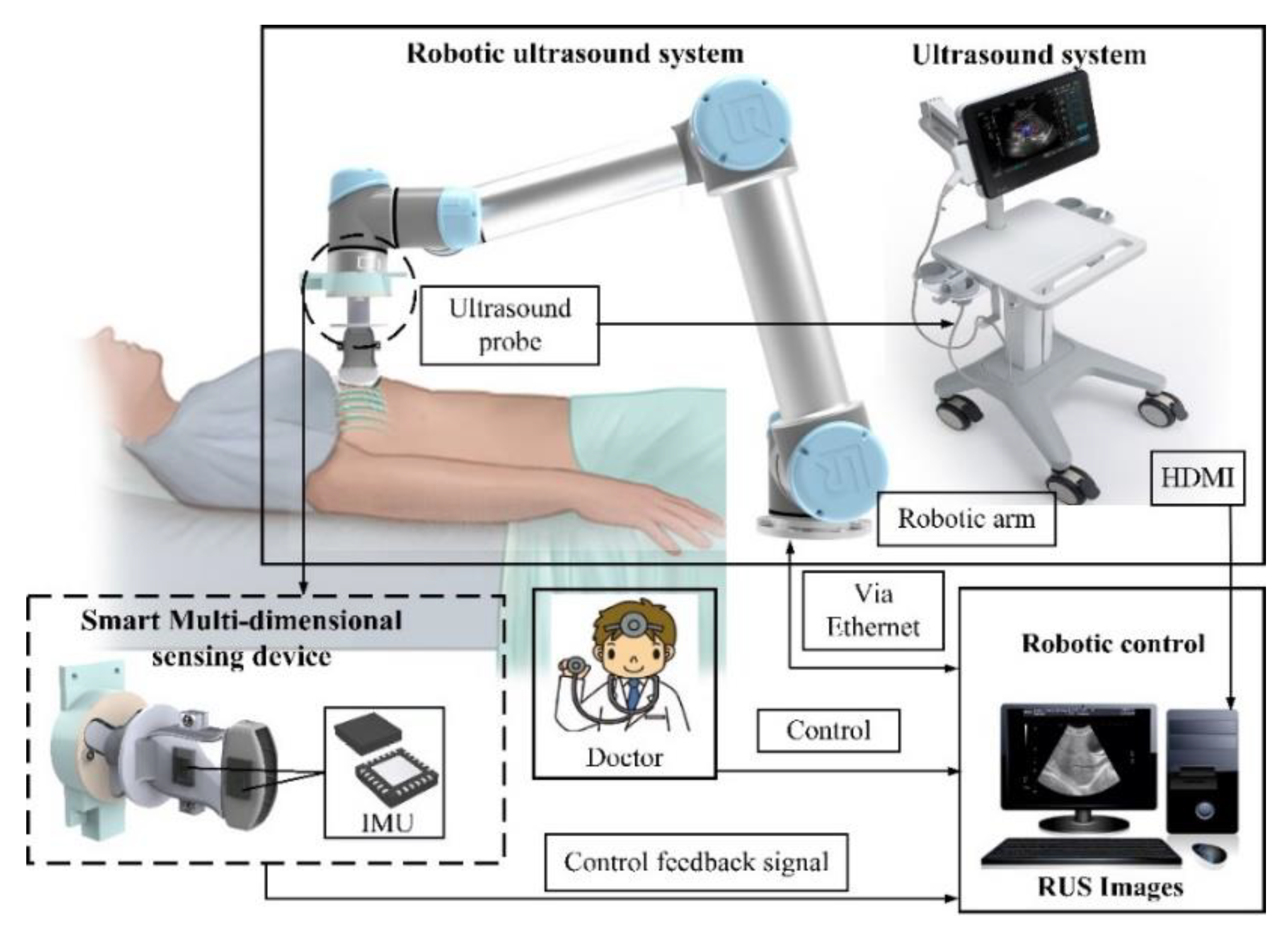 Sensors | Free Full-Text | An Improved Sensing Method of a Robotic  Ultrasound System for Real-Time Force and Angle Calibration