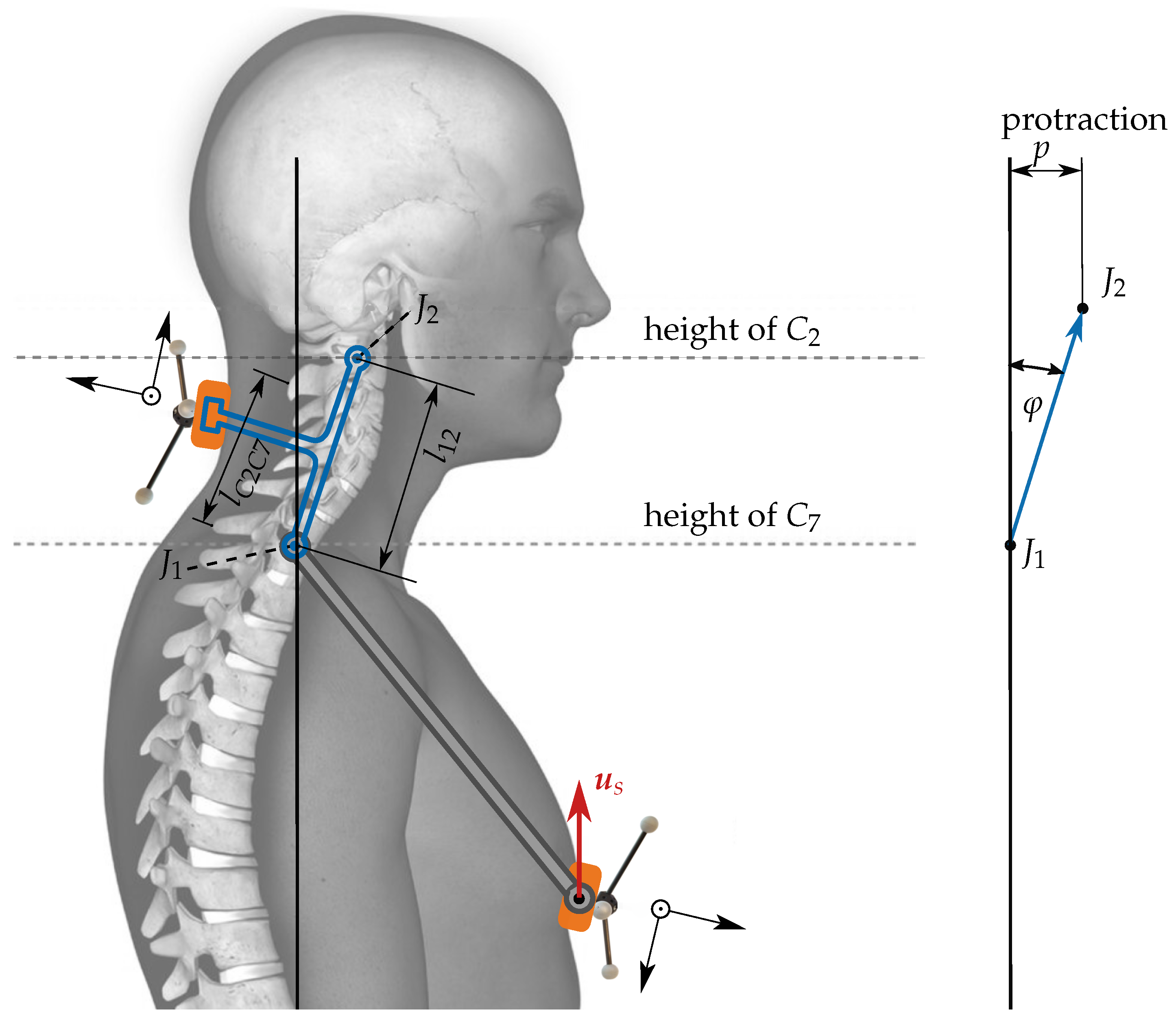 Sensors | Free Full-Text | A Two Joint Neck Model to Identify Malposition  of the Head Relative to the Thorax | HTML