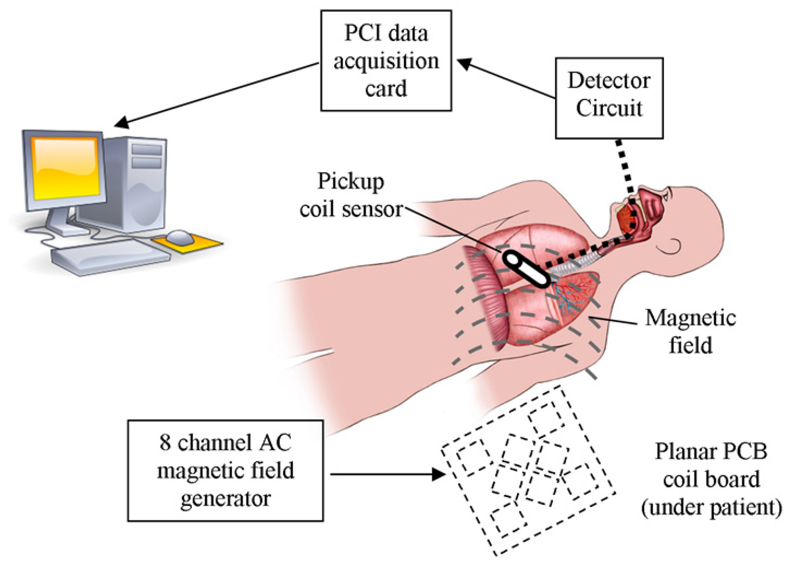 Sensors | Free Full-Text | A Radiolucent Electromagnetic Tracking System  for Use with Intraoperative X-ray Imaging