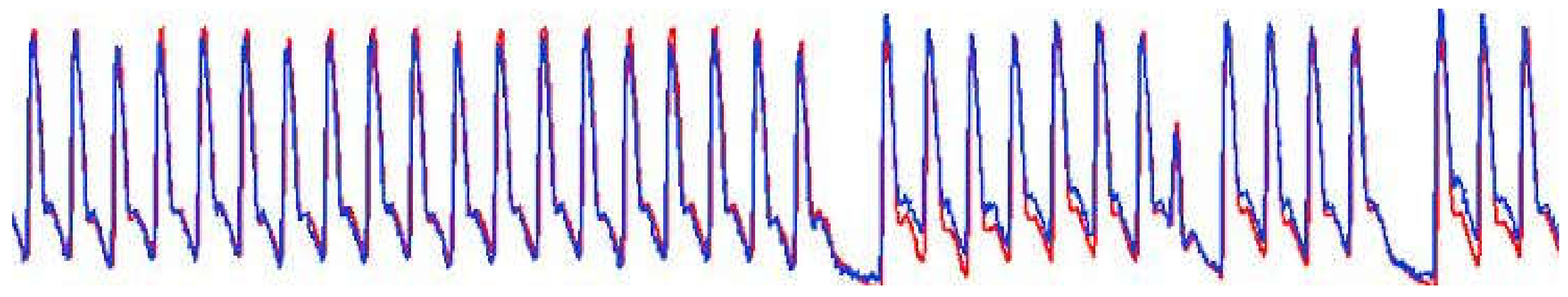 Blood pressure monitors - PyrAmes Health