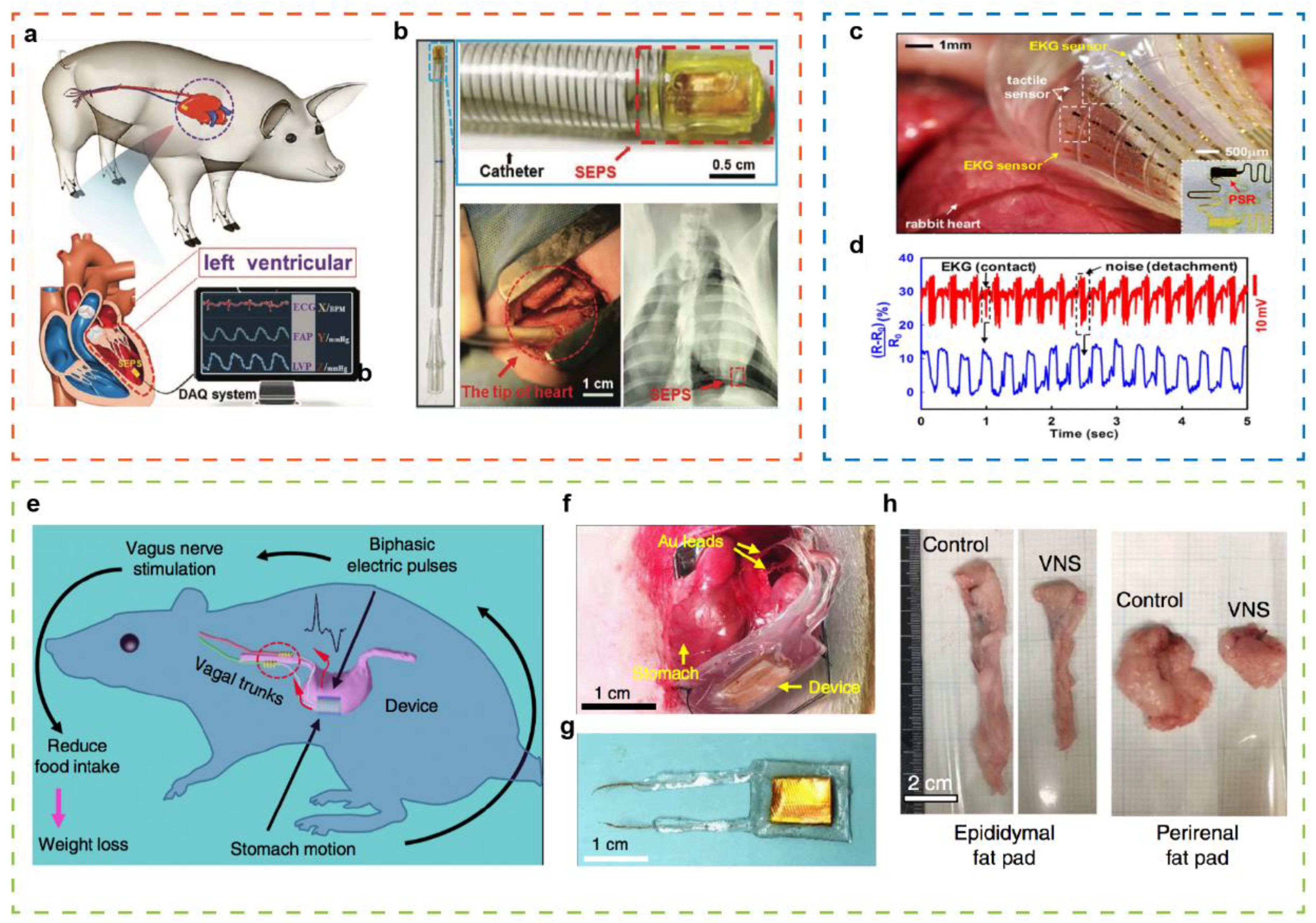 SensAct: The Soft and Squishy Tactile Sensor with Integrated Flexible  Actuator - Ozioko - 2021 - Advanced Intelligent Systems - Wiley Online  Library