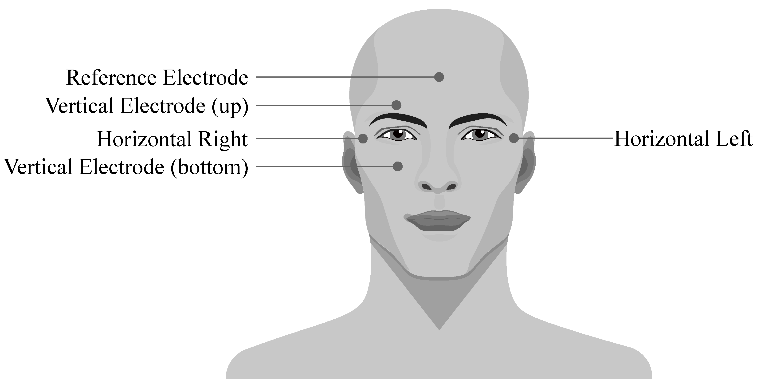 Electrode placement on the face for the both the ES and sham protocol.