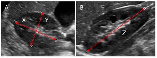 Sensors | Free Full-Text | Advanced Kidney Volume Measurement